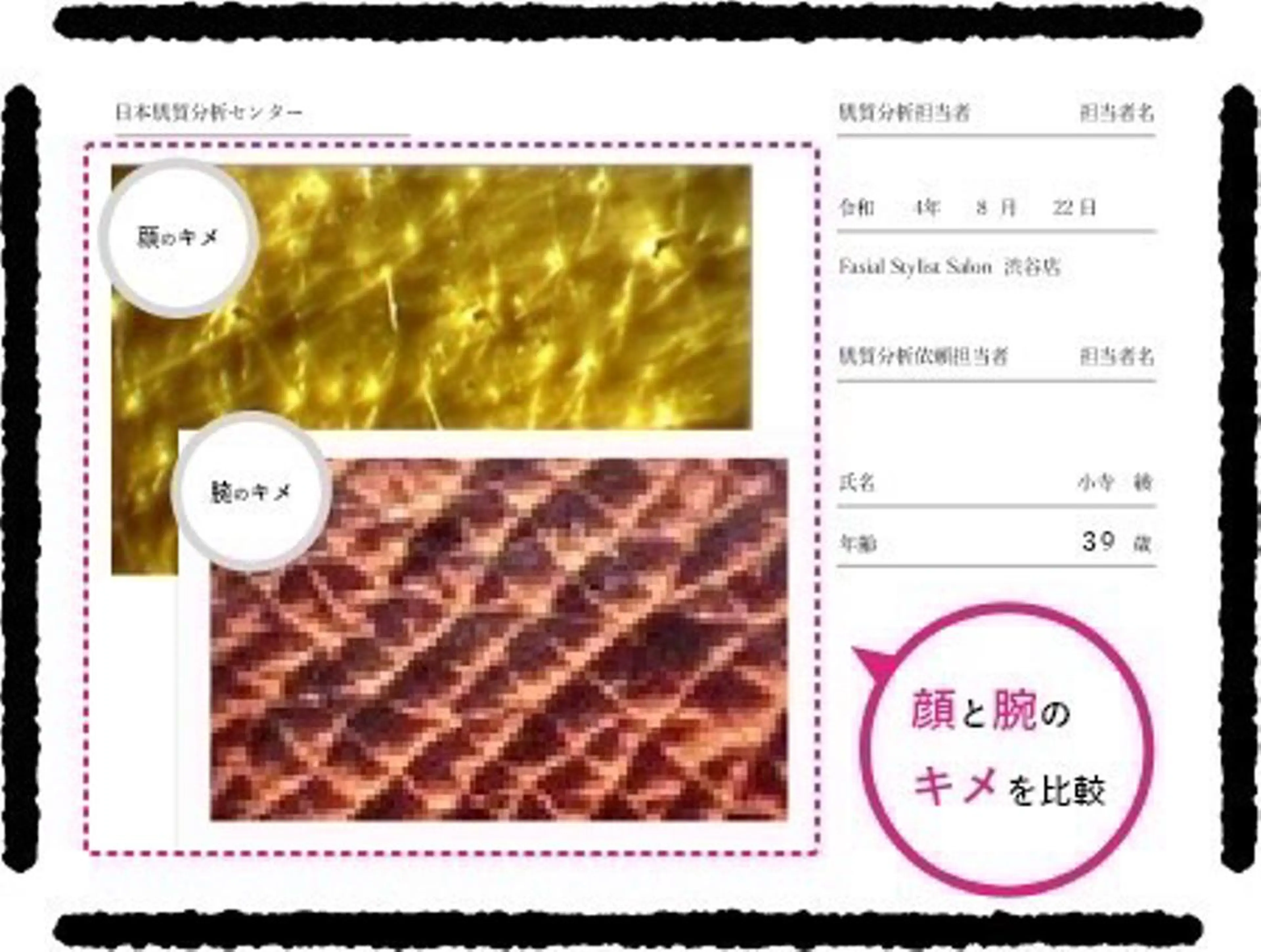 肌質改善専門サロン ／FSS渋谷店　松本のエステ・リラクイメージ