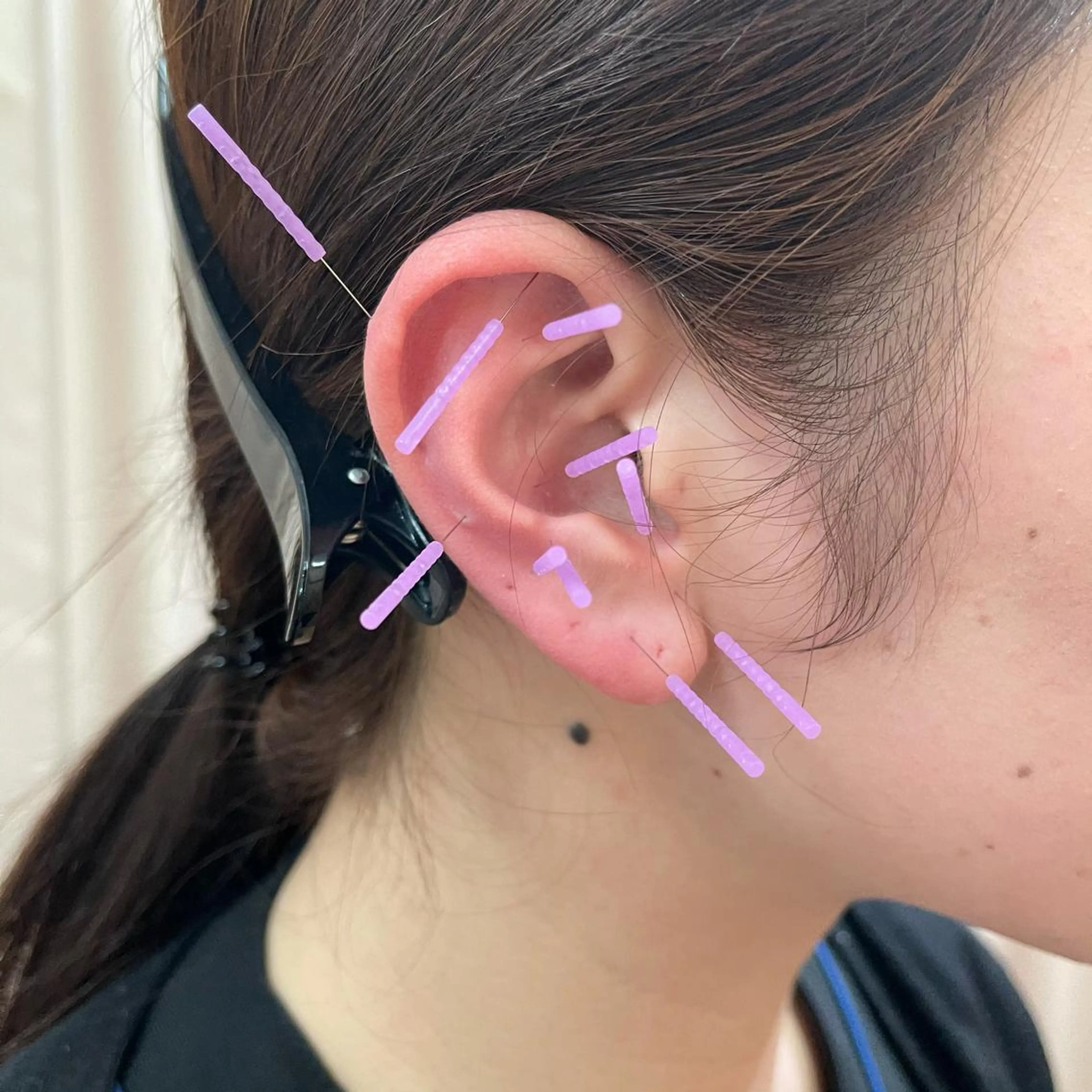 小林整骨院玉川 キジマのエステ・リラクイメージ