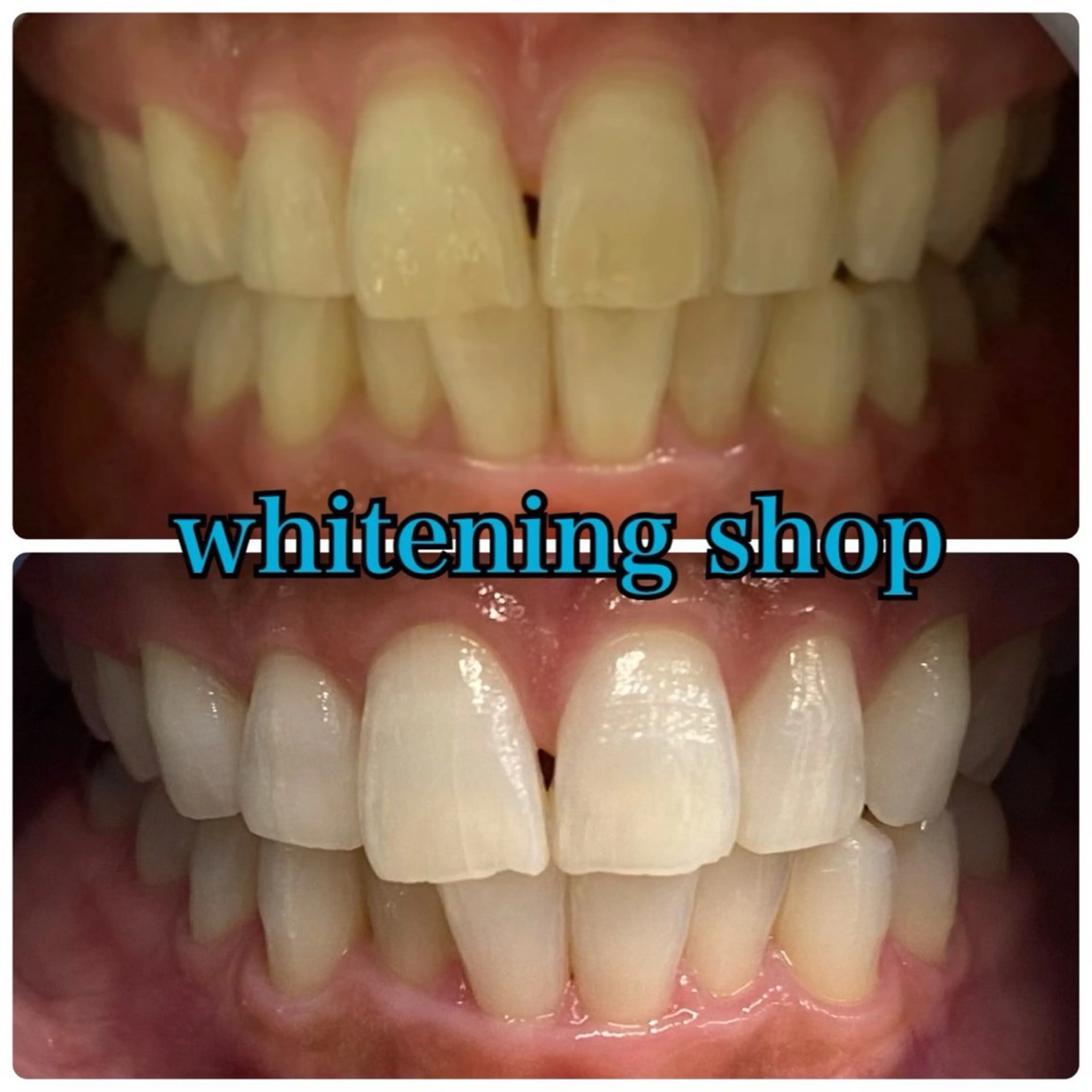 メンズ エステ リラク ホワイトニング ショップ川越店のエステ・リラクイメージ