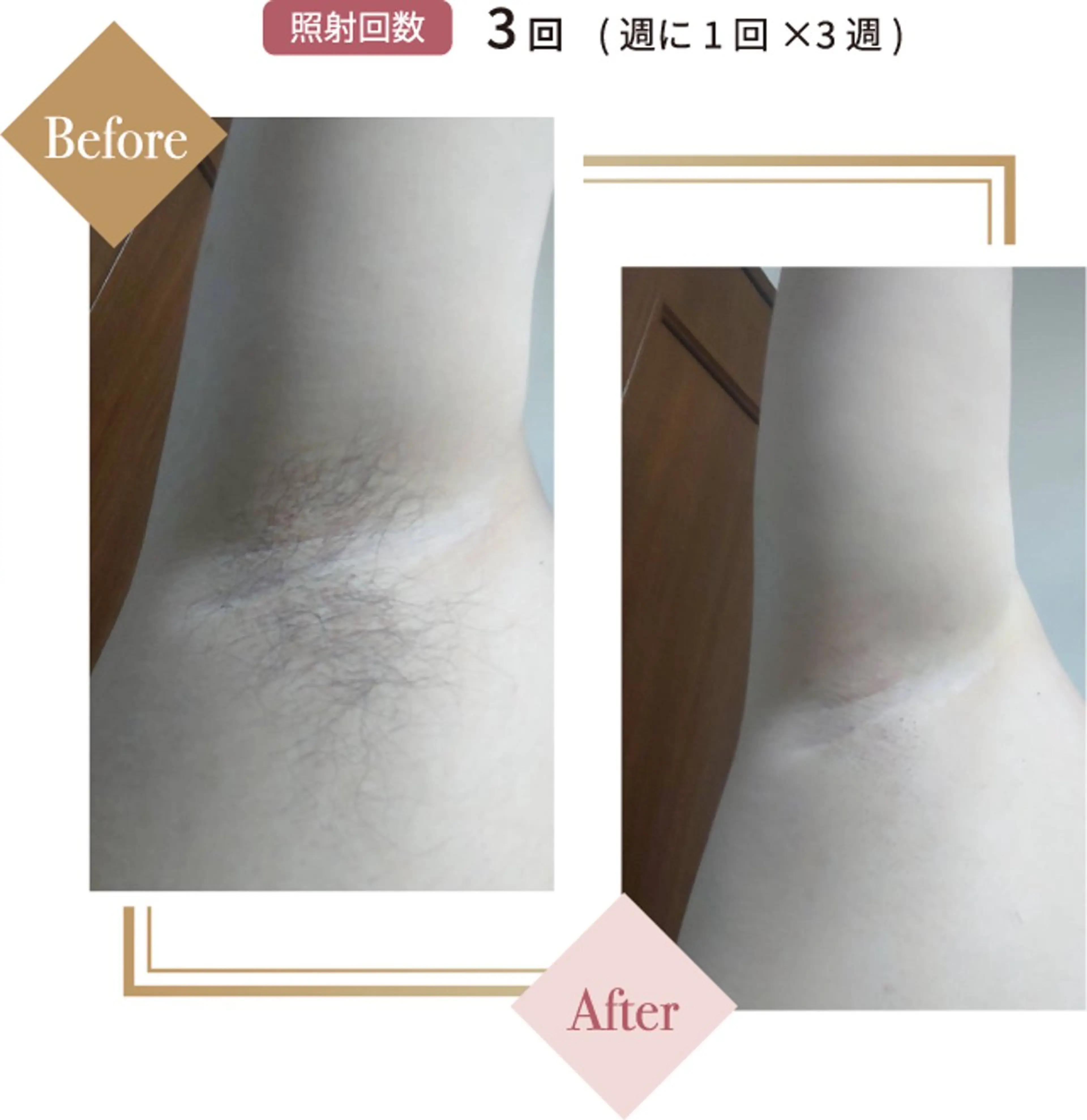 ニキビ、痩身、脱毛、 サクラチャンスパのエステ・リラクイメージ