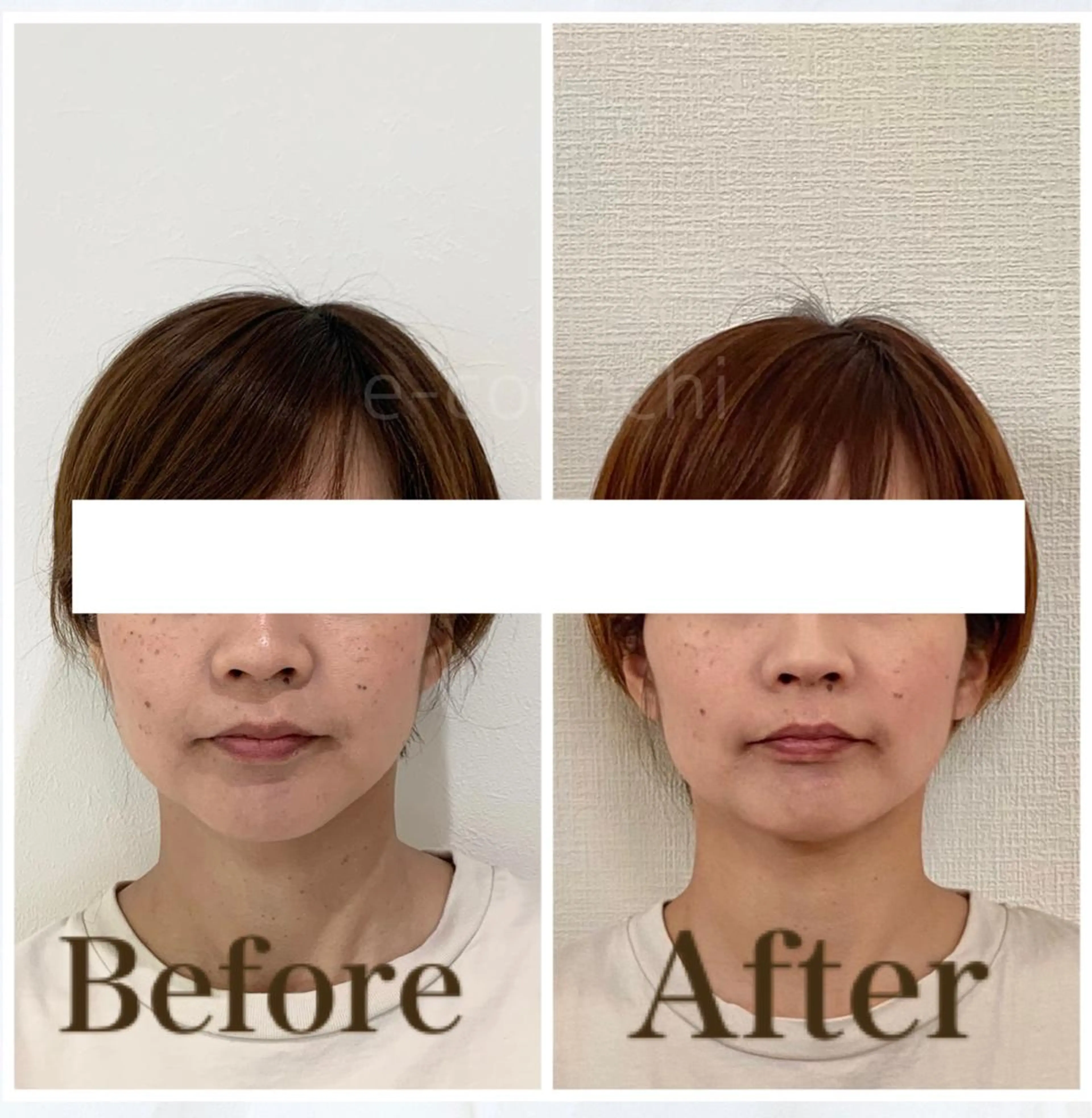 エステ リラク 小顔と ヘッドスパのお店のエステ・リラクイメージ