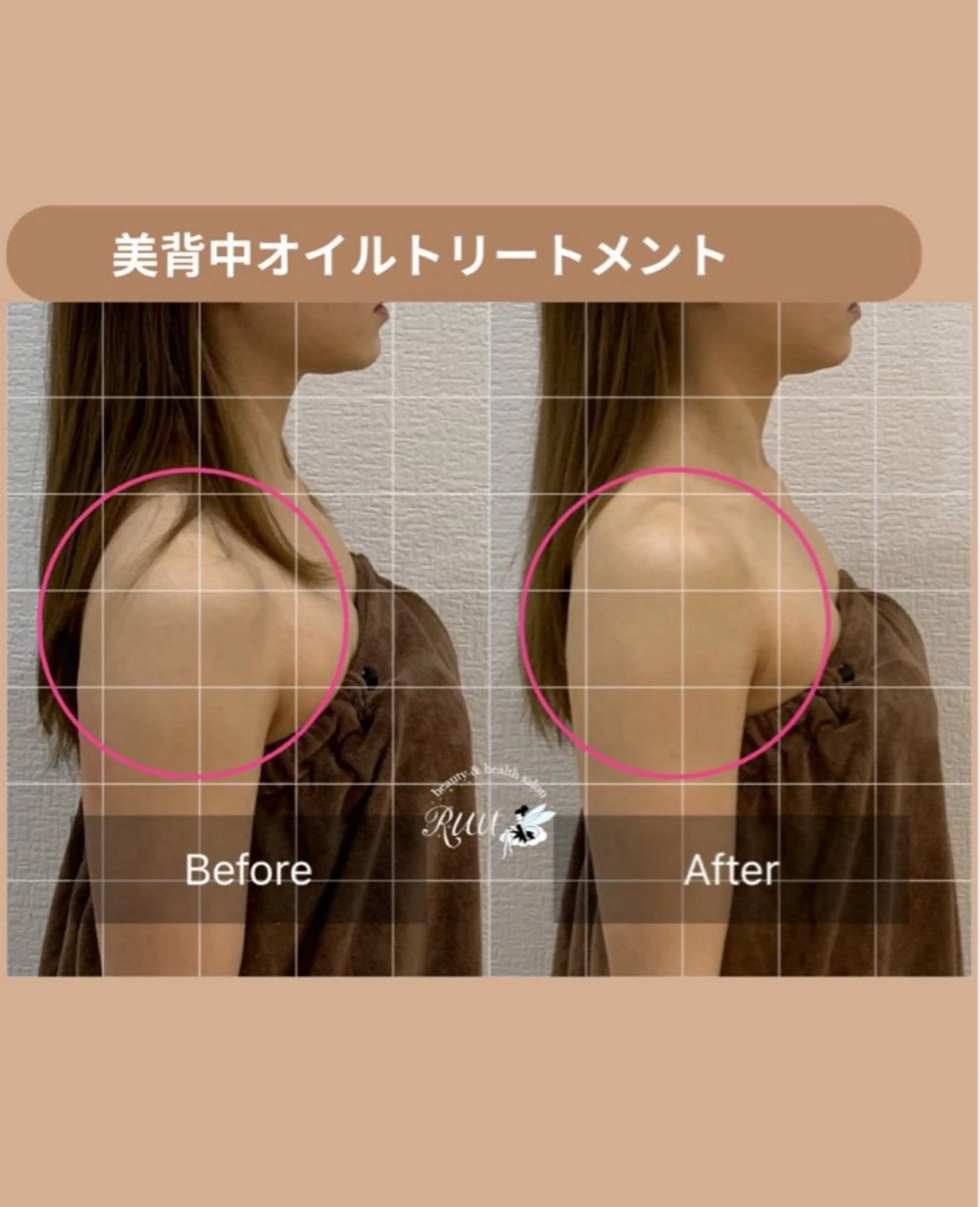 エステ リラク 【頭痛、睡眠改善】 salon RUUのエステ・リラクイメージ