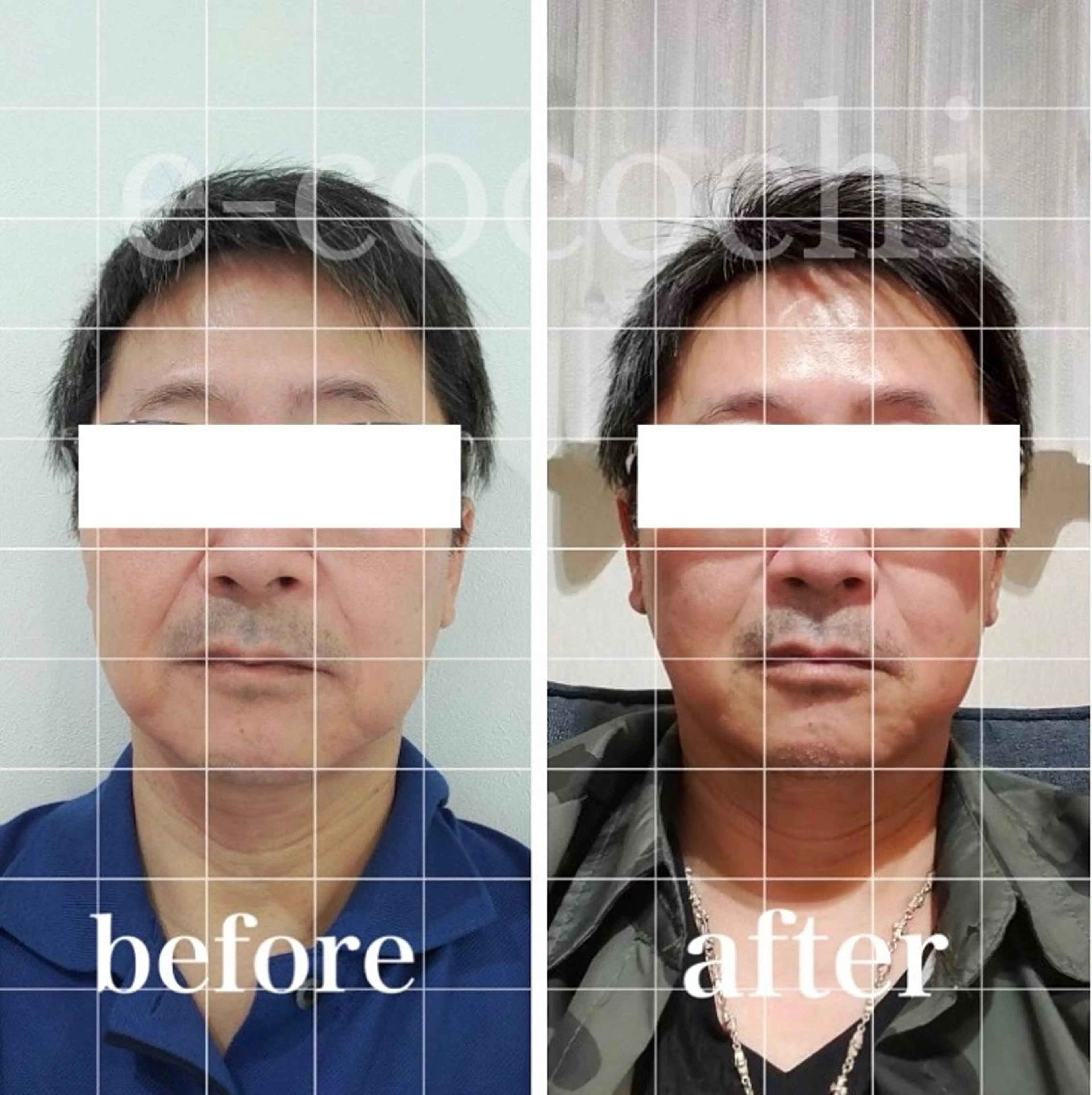 エステ リラク 小顔と ヘッドスパのお店のエステ・リラクイメージ