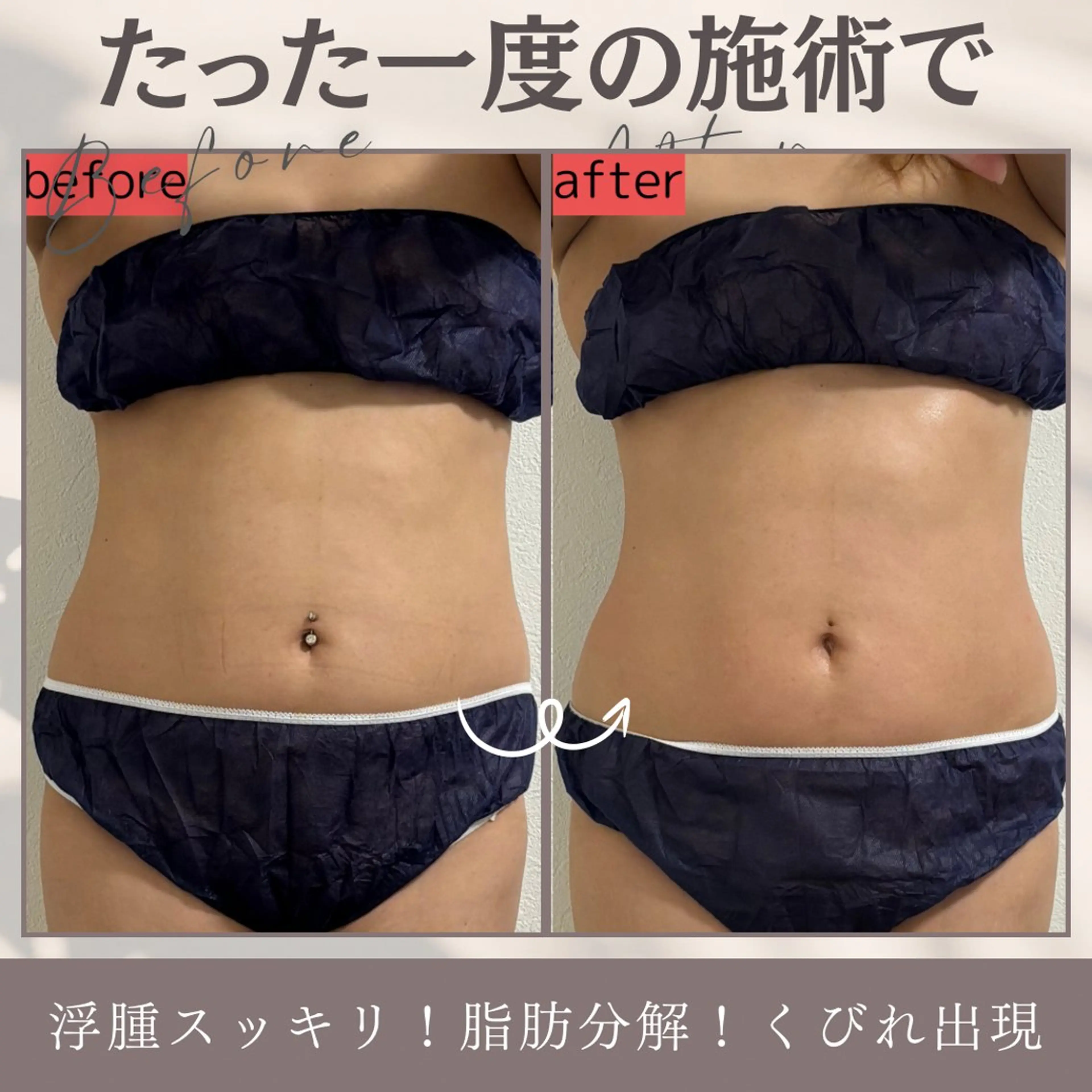 まだ間に合う夏が終わる前に!!《全身贅沢ケア150分》の写真