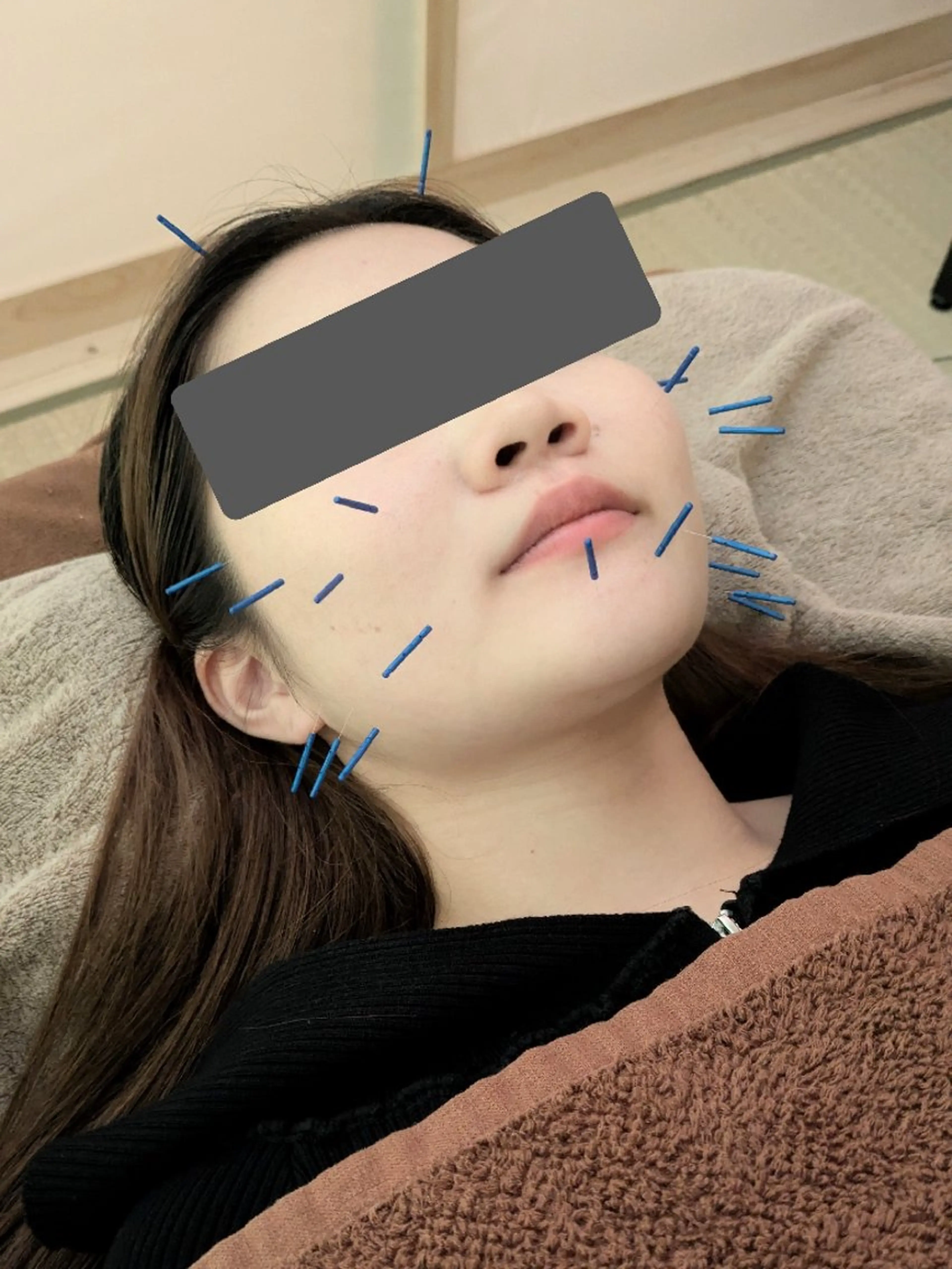 エステ かえるのサロン所属・函南の美容鍼灸アロマ かえるのサロン🐸のエステ・リラクイメージ