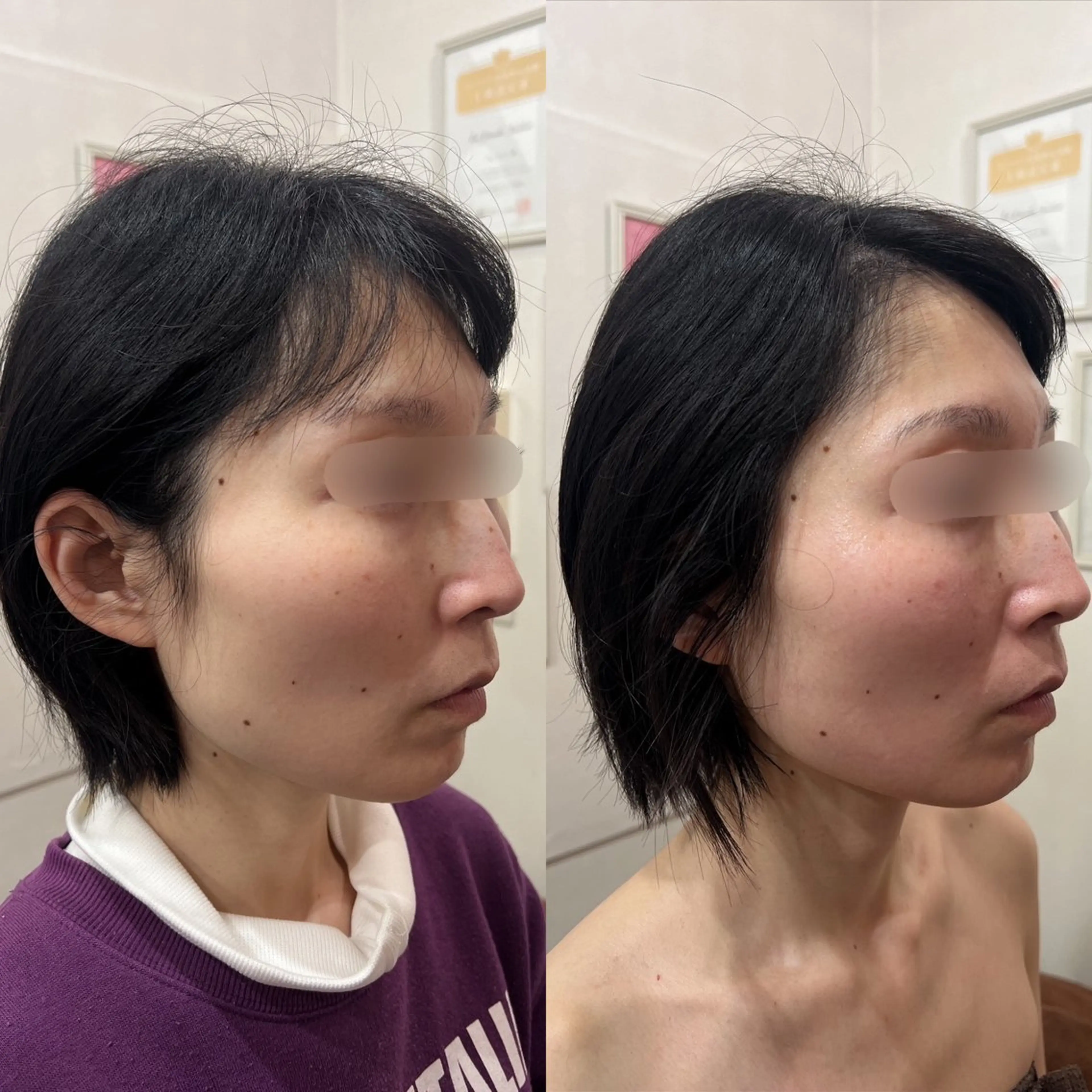 毛穴改善/脱毛 ネイル　川上久仁子のエステ・リラクイメージ