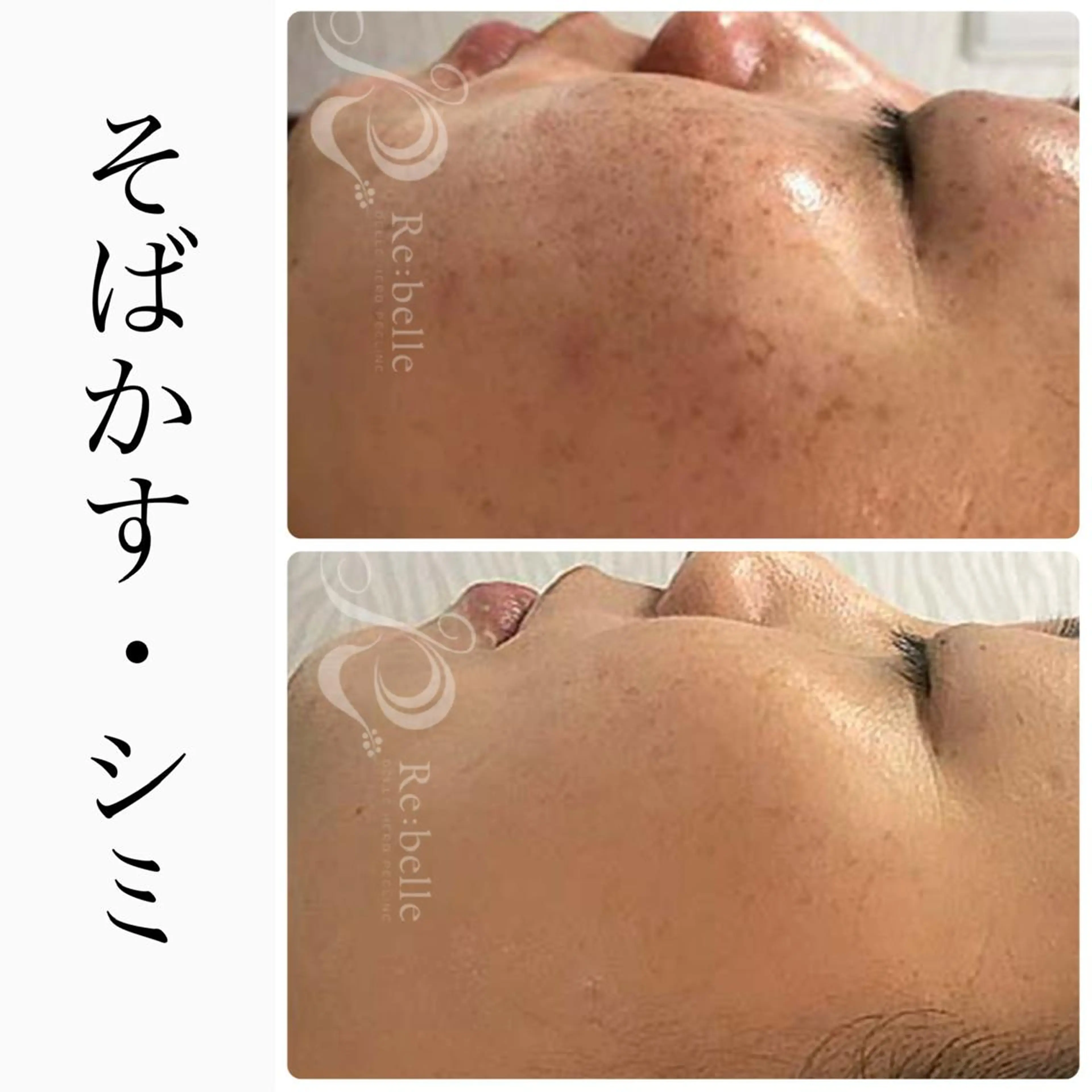 エステ ハーブピーリング専門 BIOEL横浜のエステ・リラクイメージ