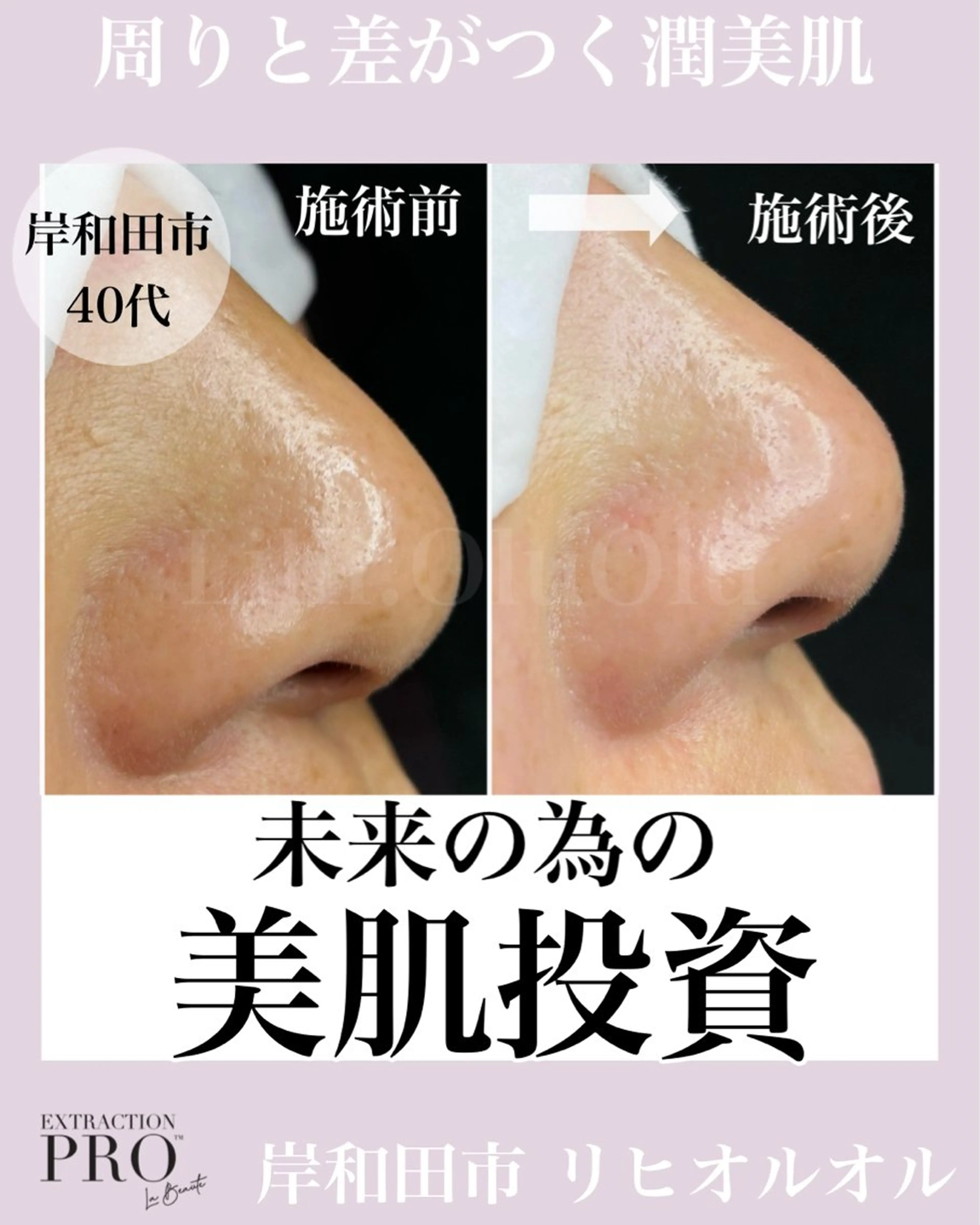 毛穴汚れ改善専門店/ 岸和田/リヒオルオルのエステ・リラクイメージ