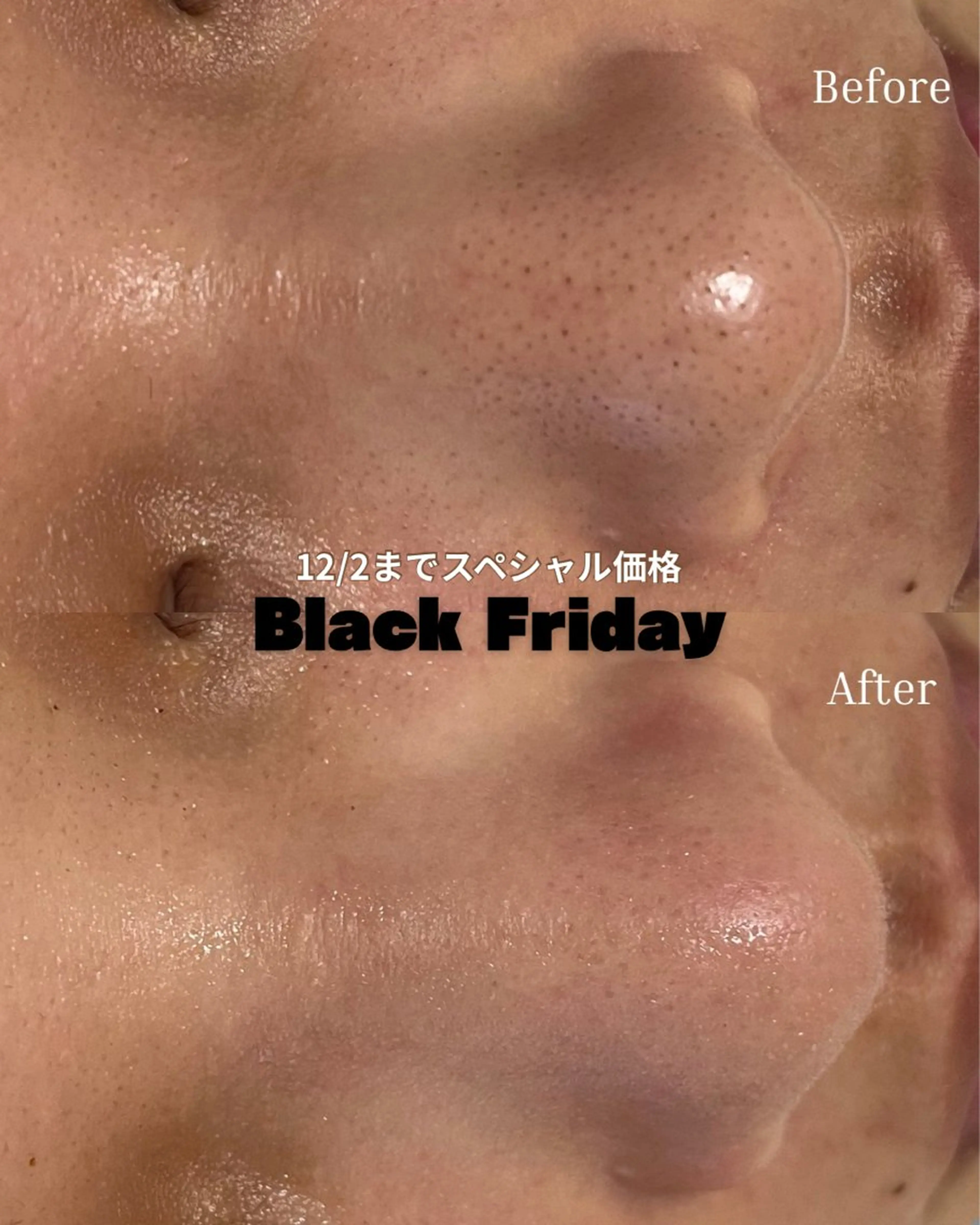 BELLIS HUIT所属・ハーブピーリング那覇 BELLISHUITのエステ・リラクイメージ