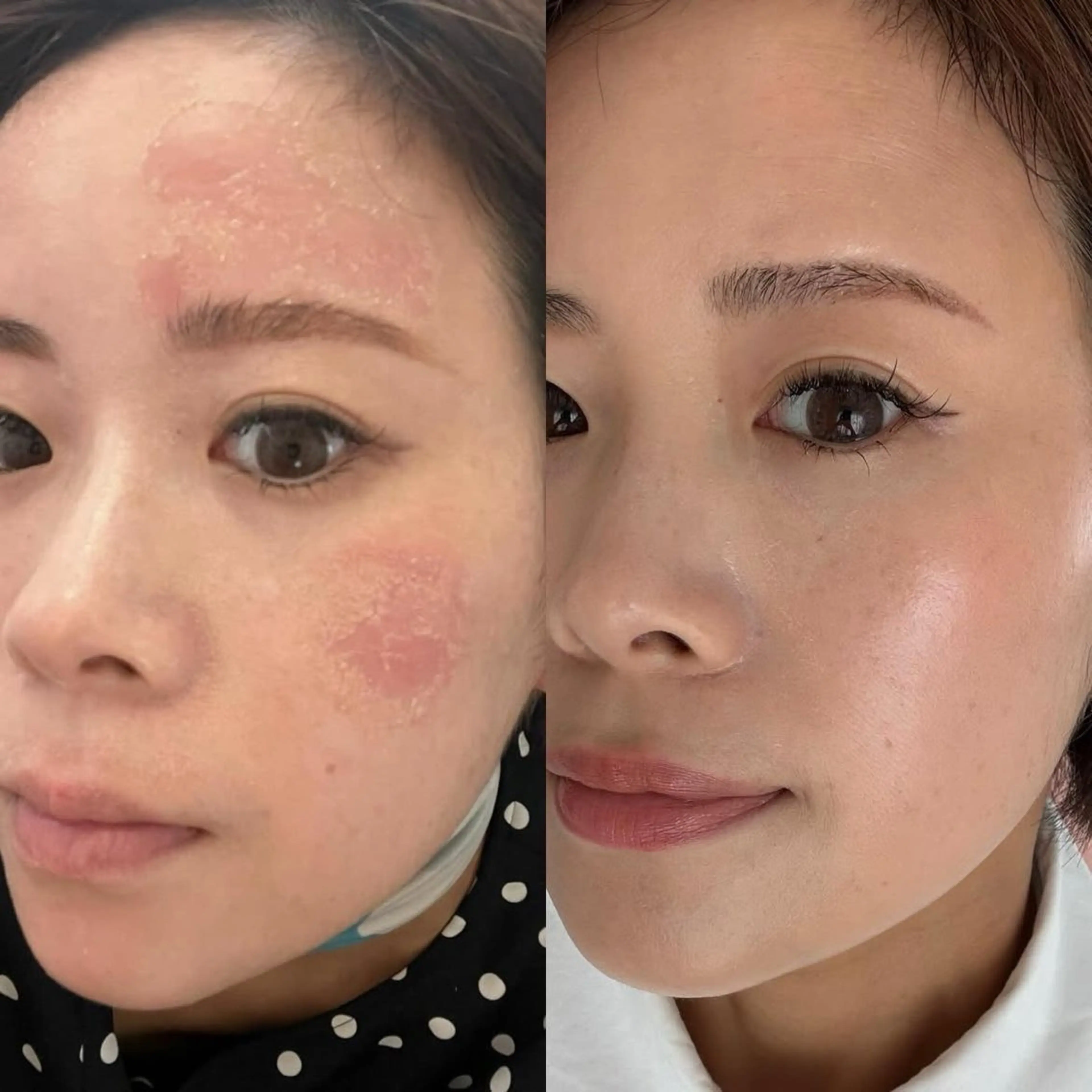 その他 【vidyto】ヴィディトゥ所属・肌管理サロン vidyto　MOEのその他イメージ