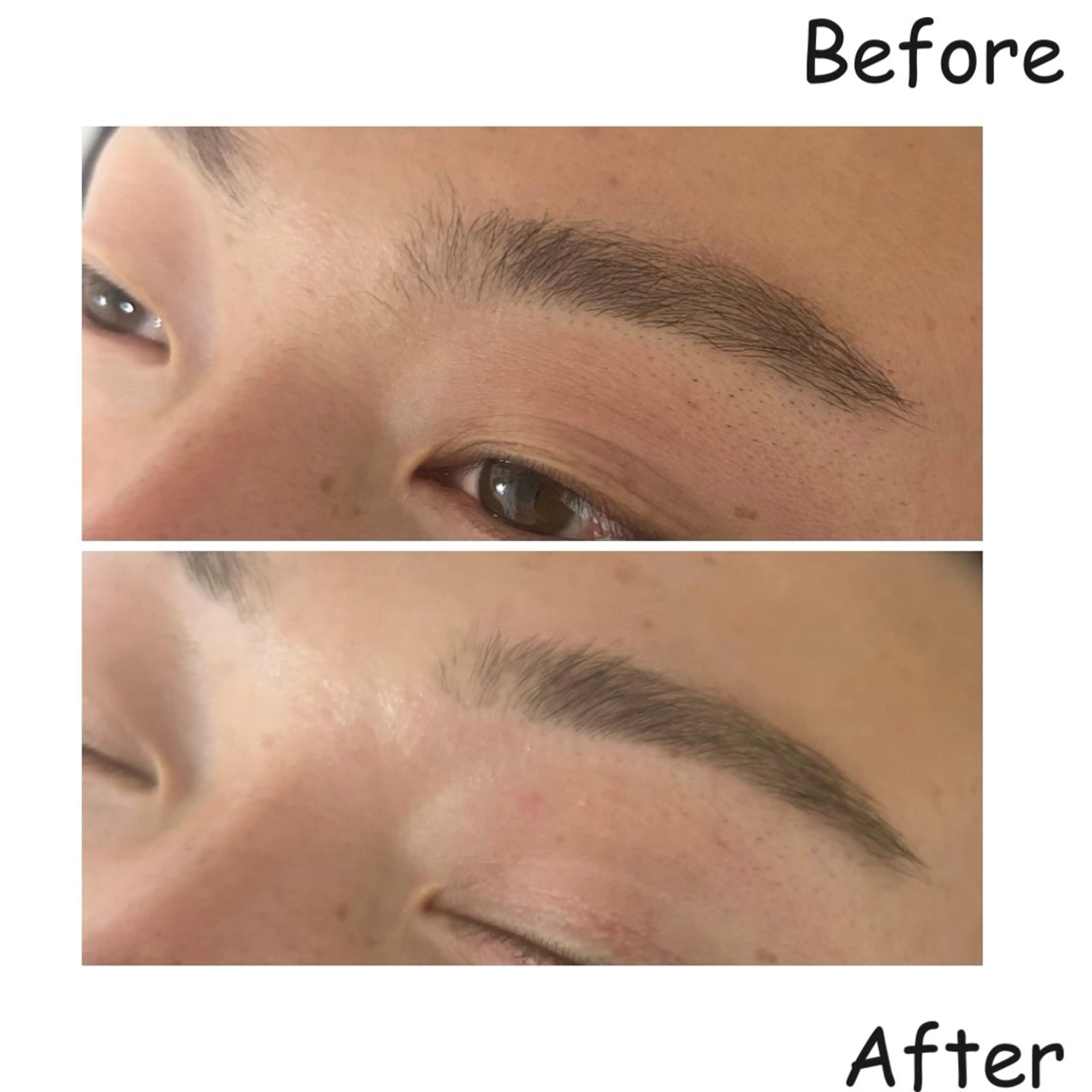 メンズ ワックス脱毛 エマニエル USAのその他イメージ