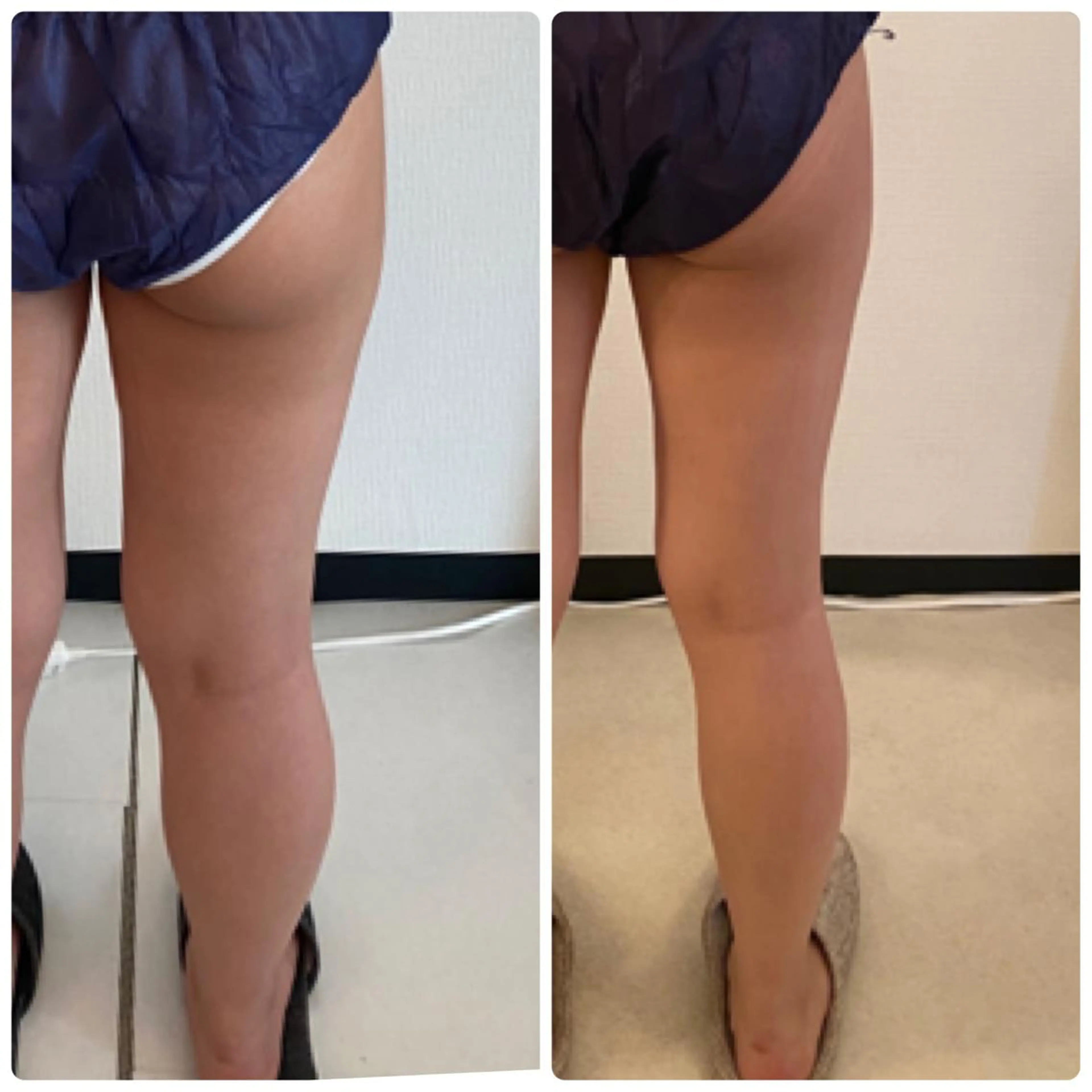 FLEUR大阪・整体 ・ハイフ・痩身・小顔のエステ・リラクイメージ