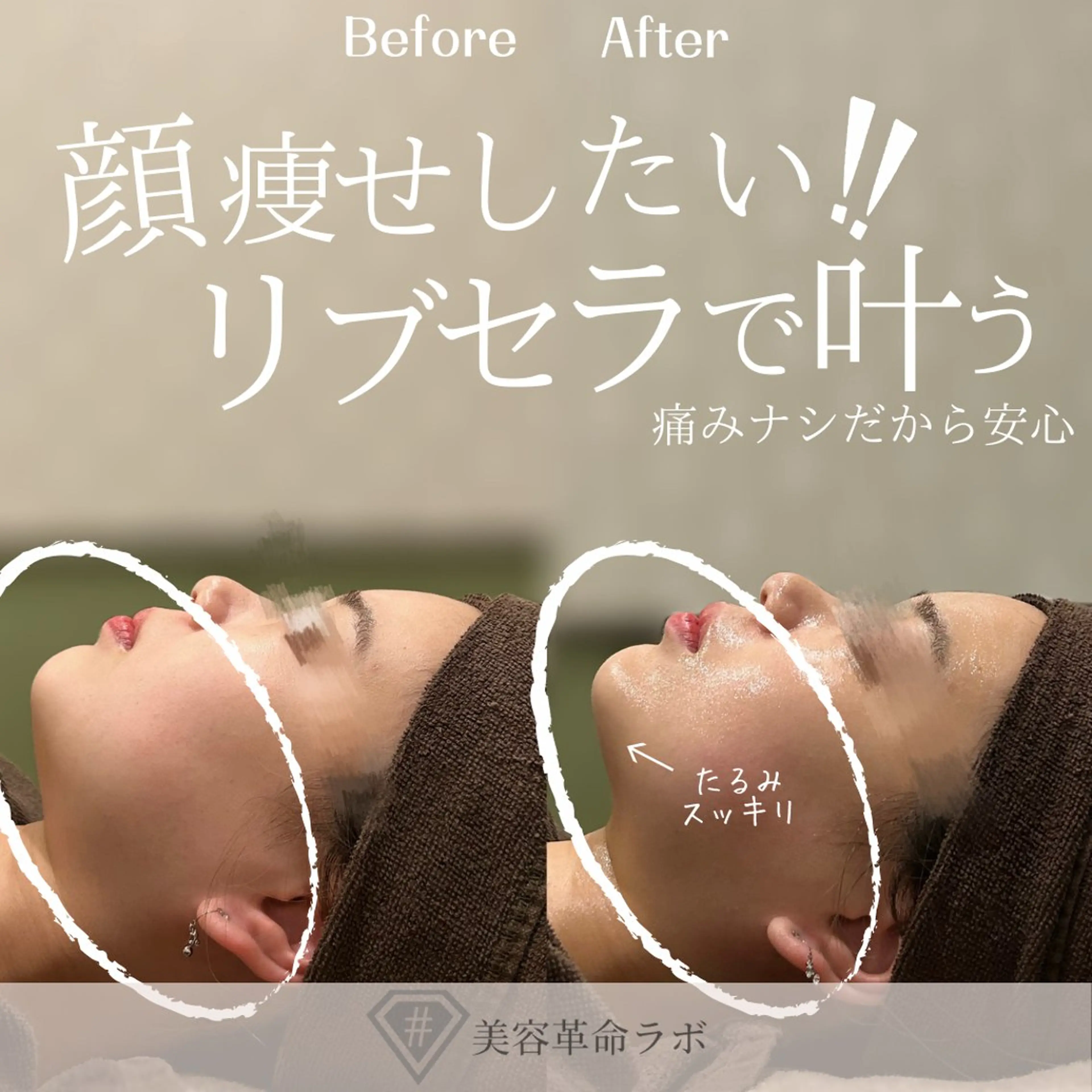 エステ 💎美容革命ラボ💎 大名店のエステ・リラクイメージ