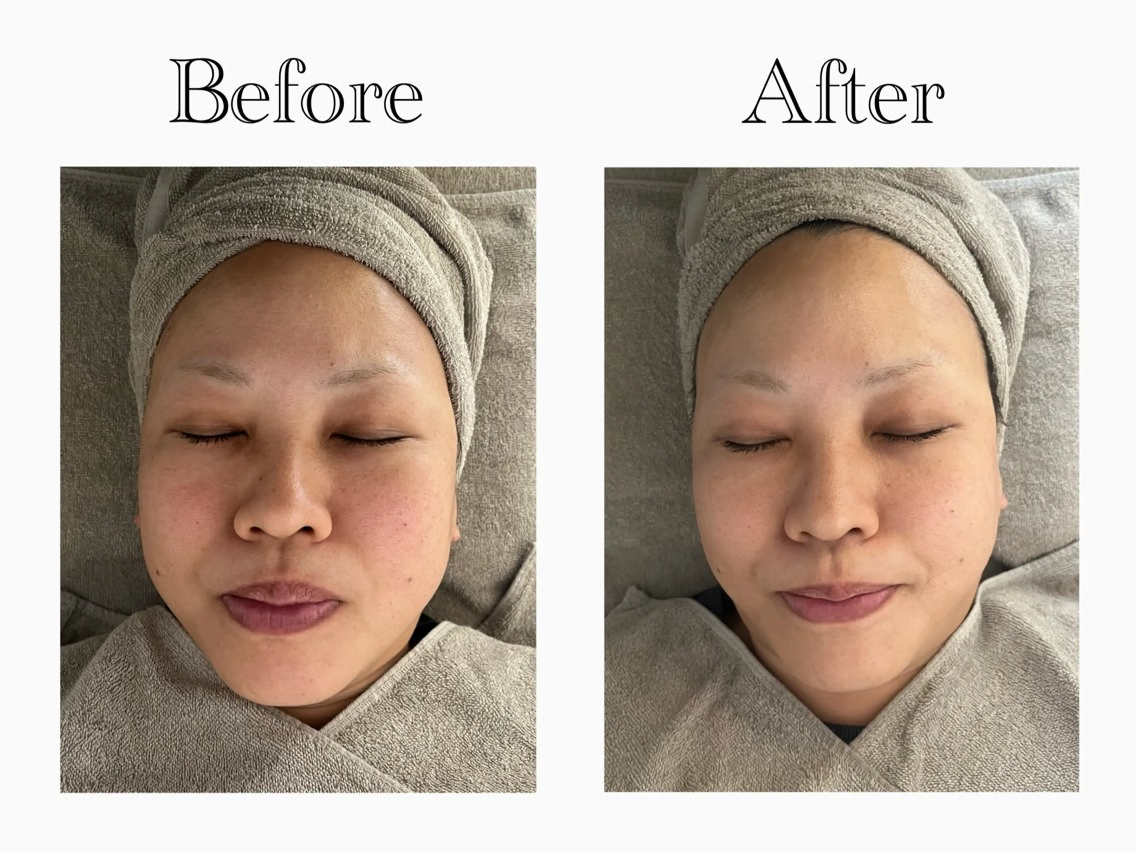 エステ リラク 【Salon D】 HALUのエステ・リラクイメージ