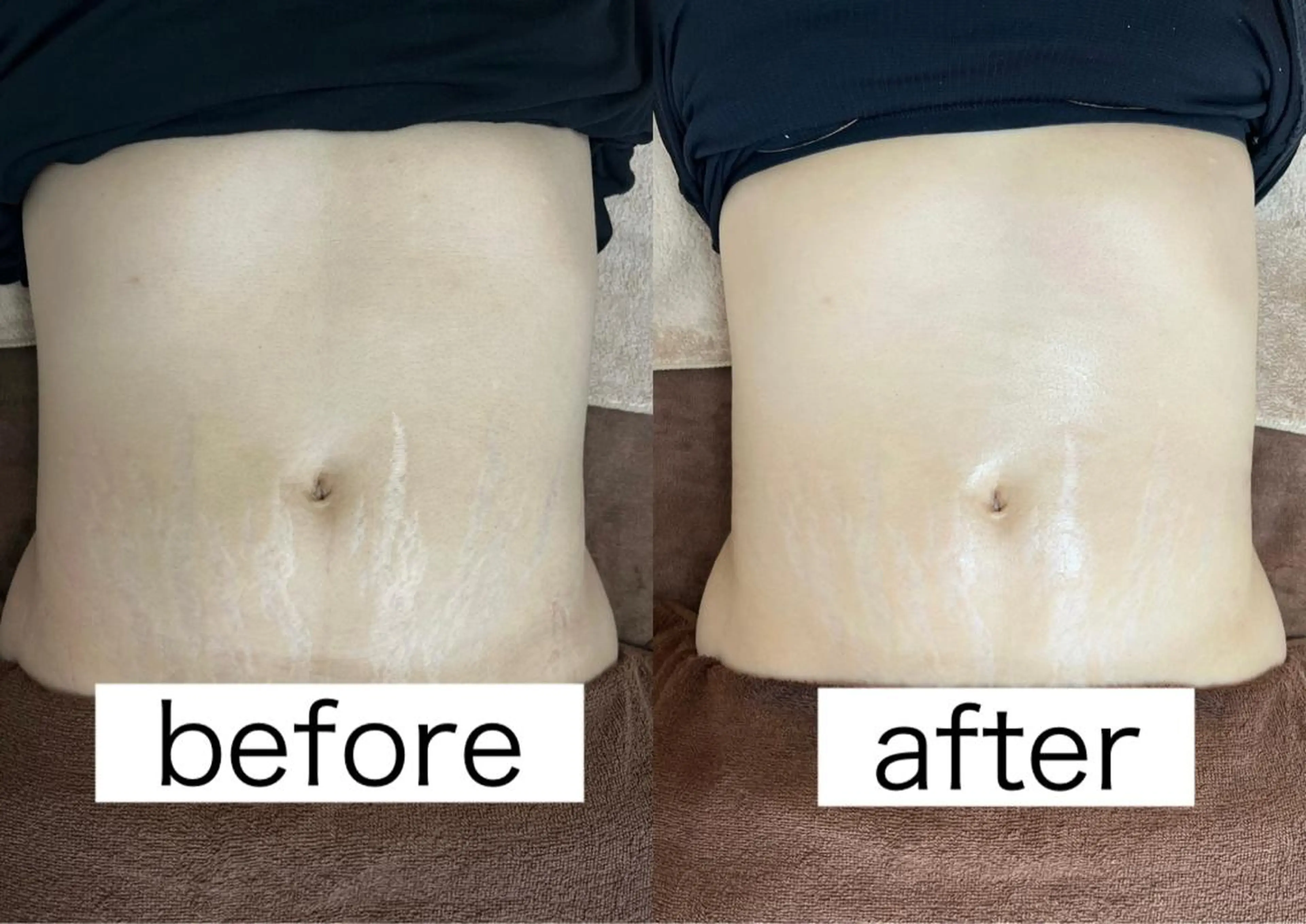 Beauty   Salon  Adiy所属・Adiy ikumiのエステ・リラクイメージ