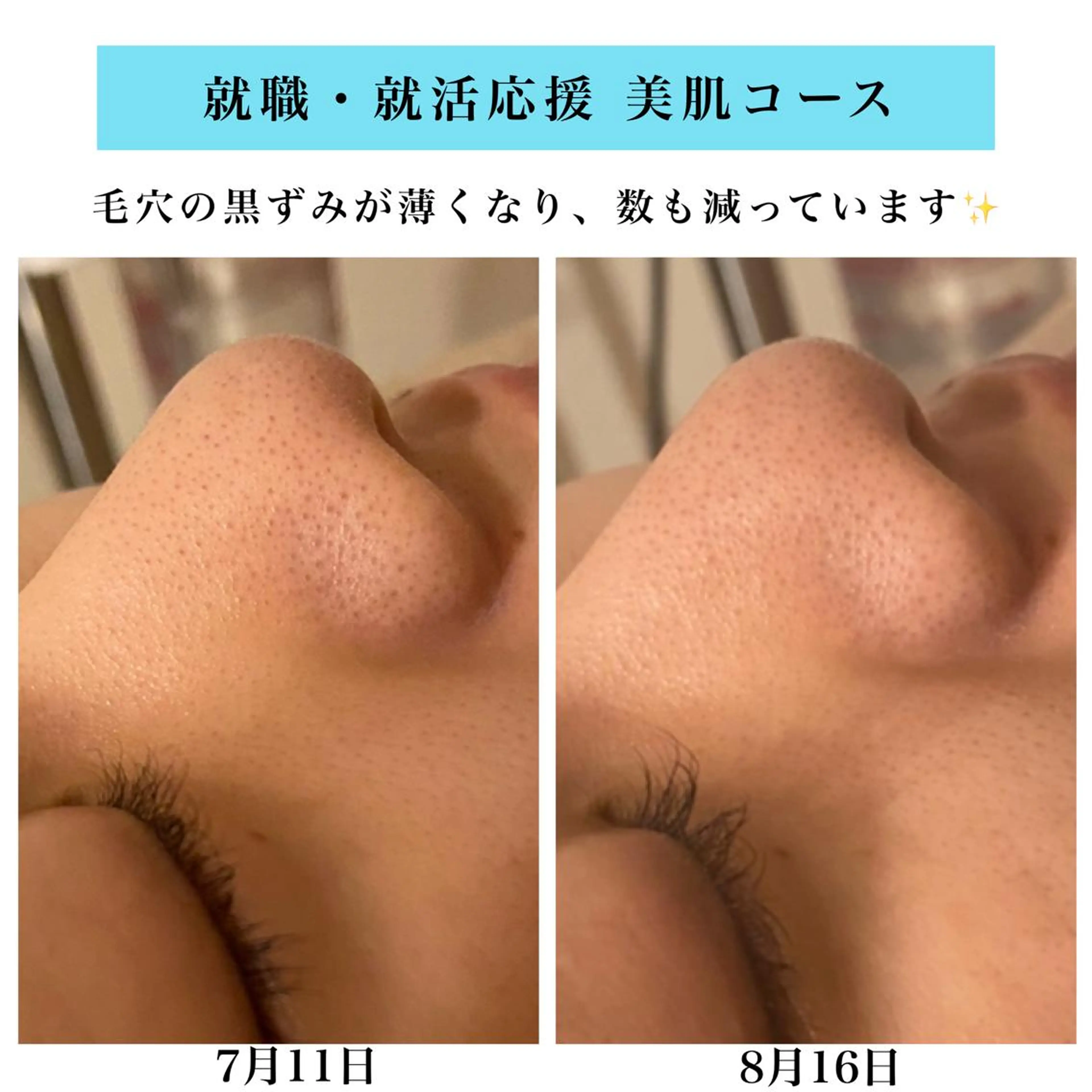 エステ Bellesthe （ベルエステ）のエステ・リラクイメージ