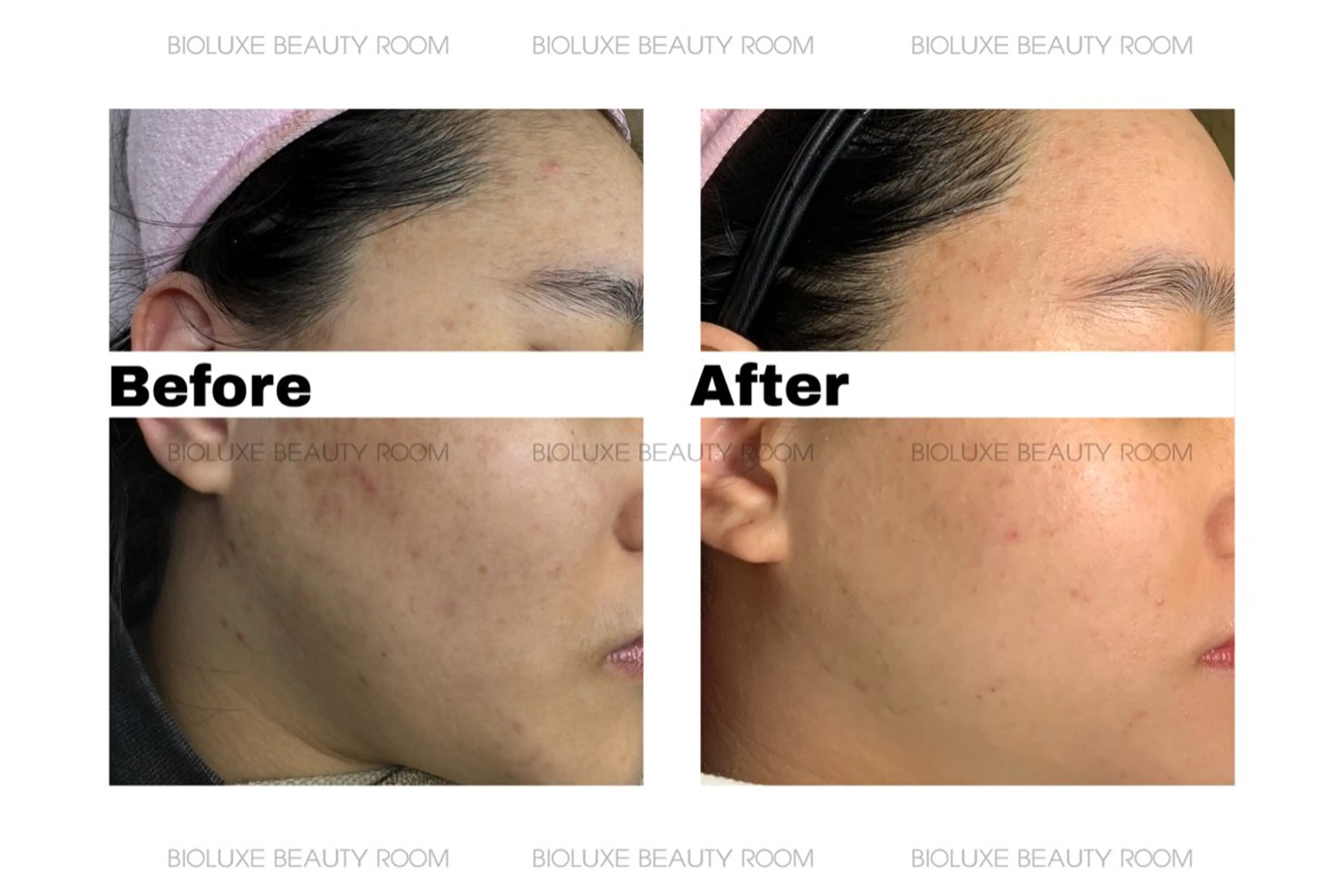 BIOLUXE BEAUTY所属・バイオラックス ビューティーのエステ・リラクイメージ