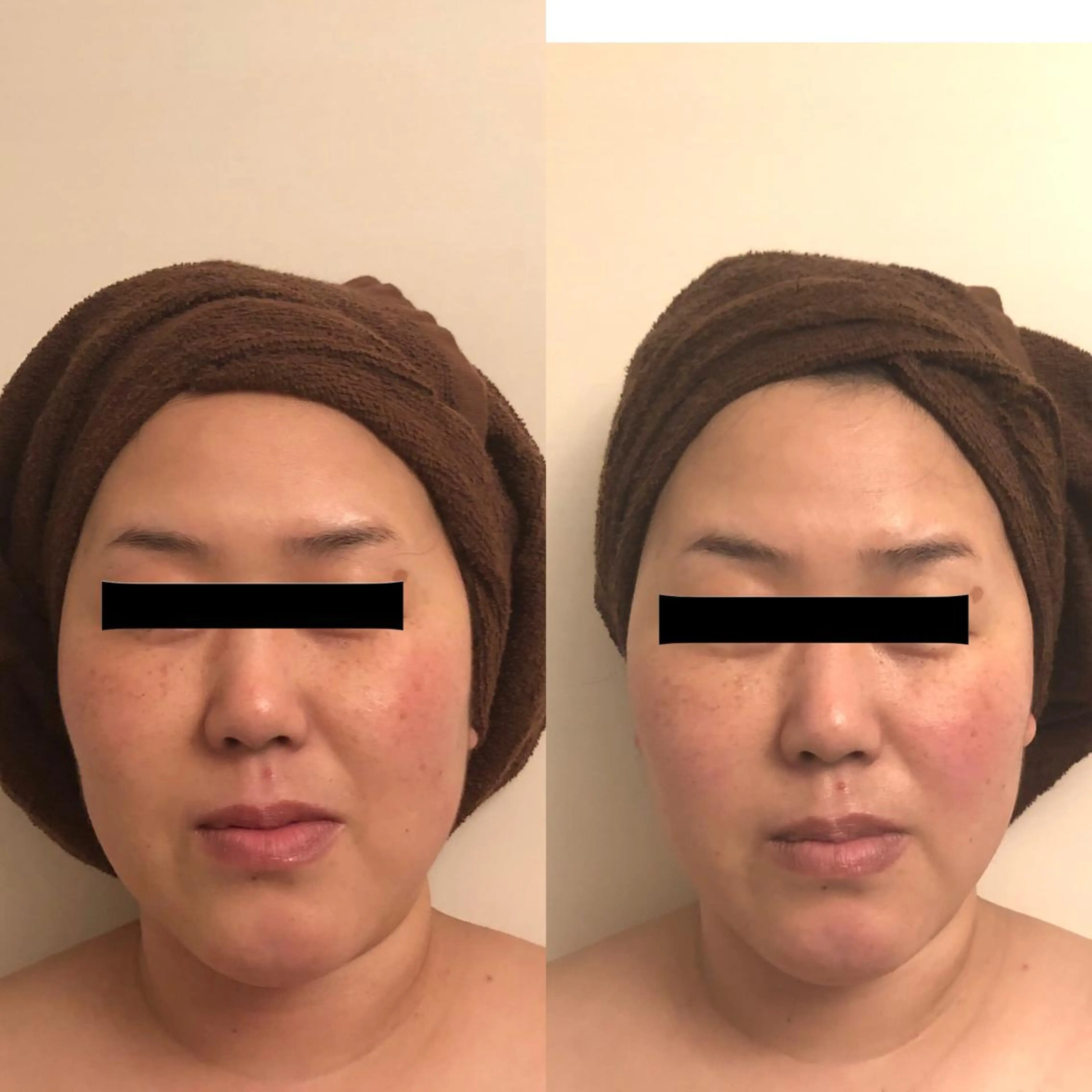 おうちサロン B-ROOMのエステ・リラクイメージ