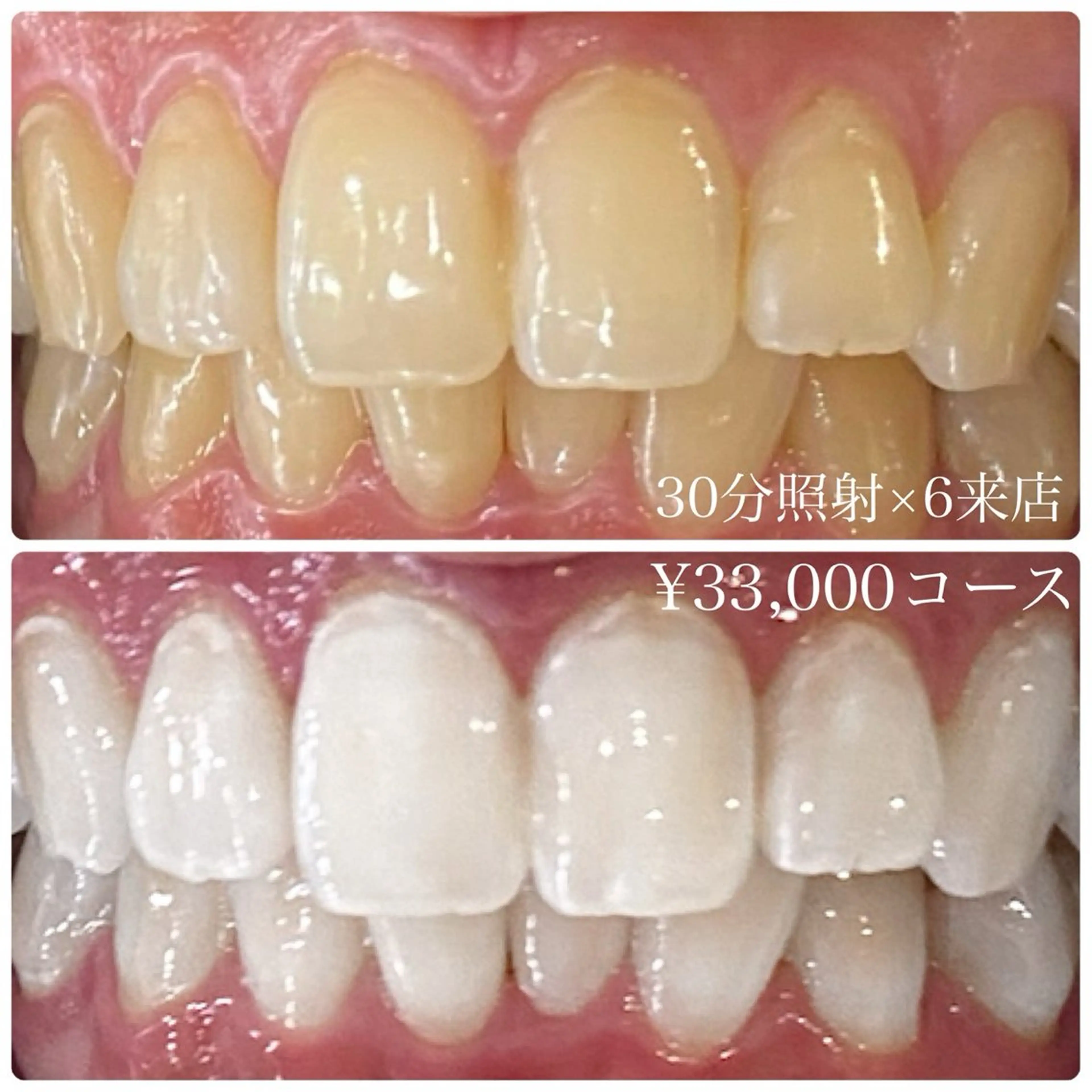 PLATINUM Beauty 横浜店所属・ホワイトニングルーム 横浜店のその他イメージ