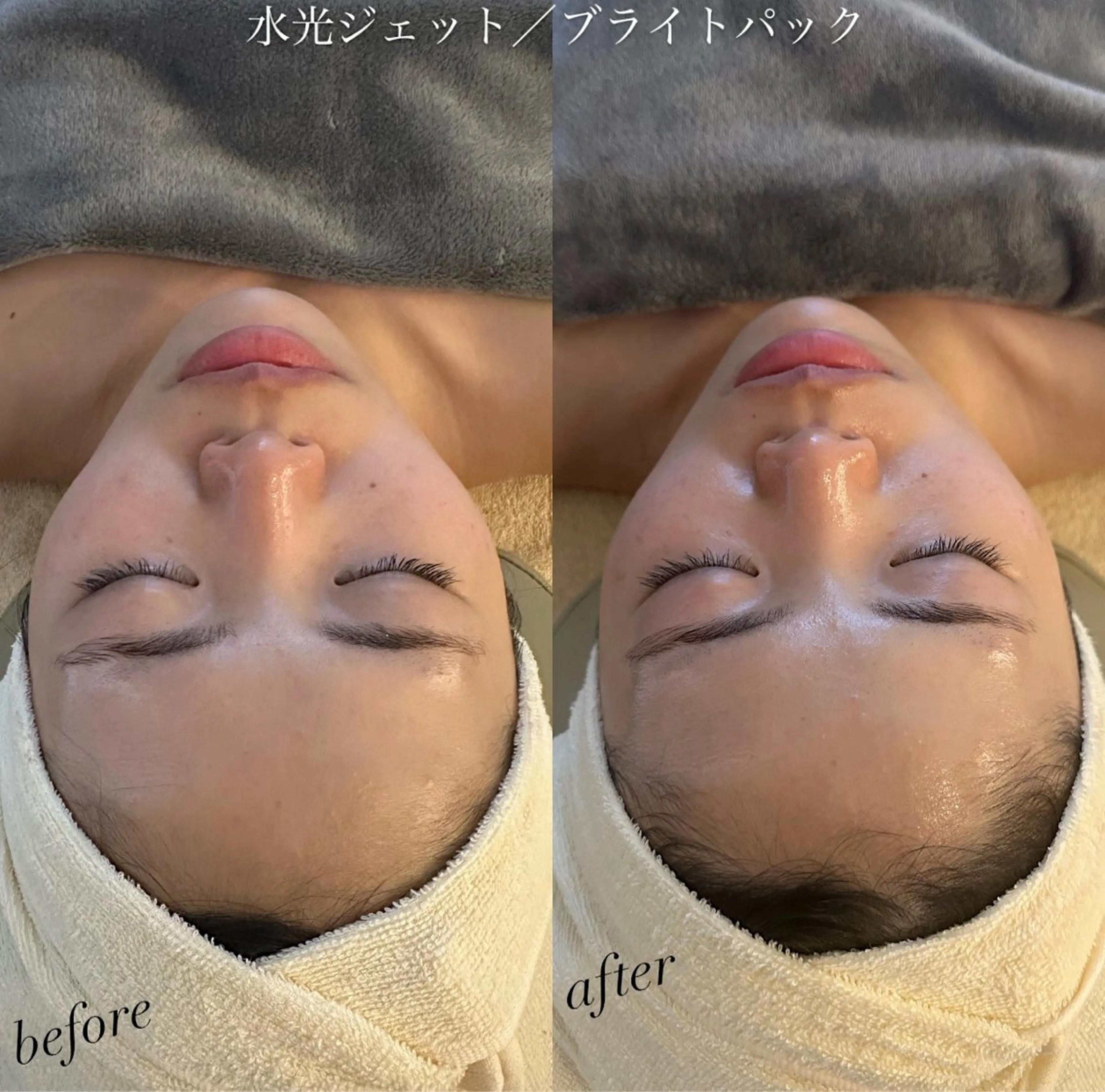 エステ うなじ脱毛/美肌脱毛 LABELのエステ・リラクイメージ