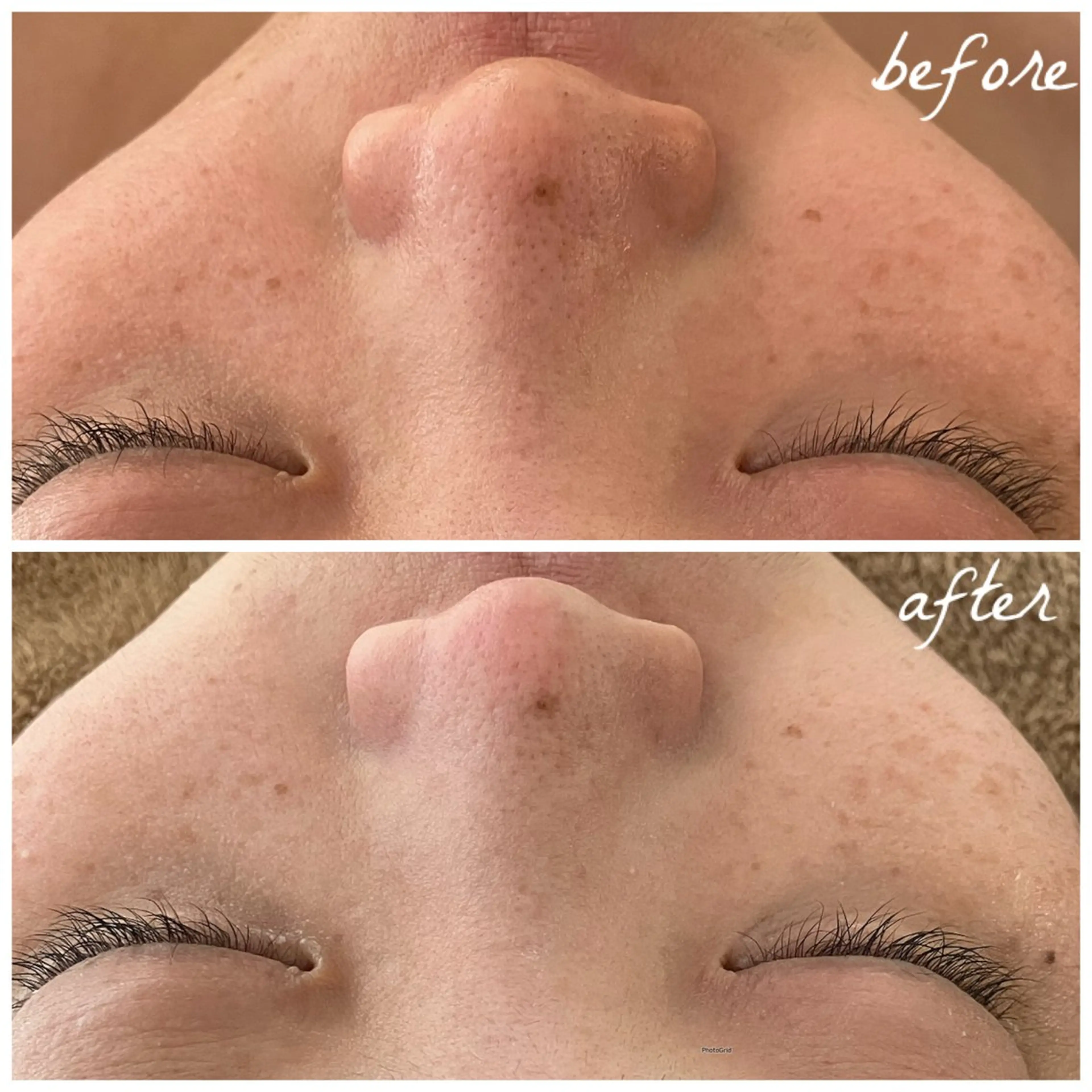 メンズ エステ メナード岐阜茜部 杉浦のエステ・リラクイメージ