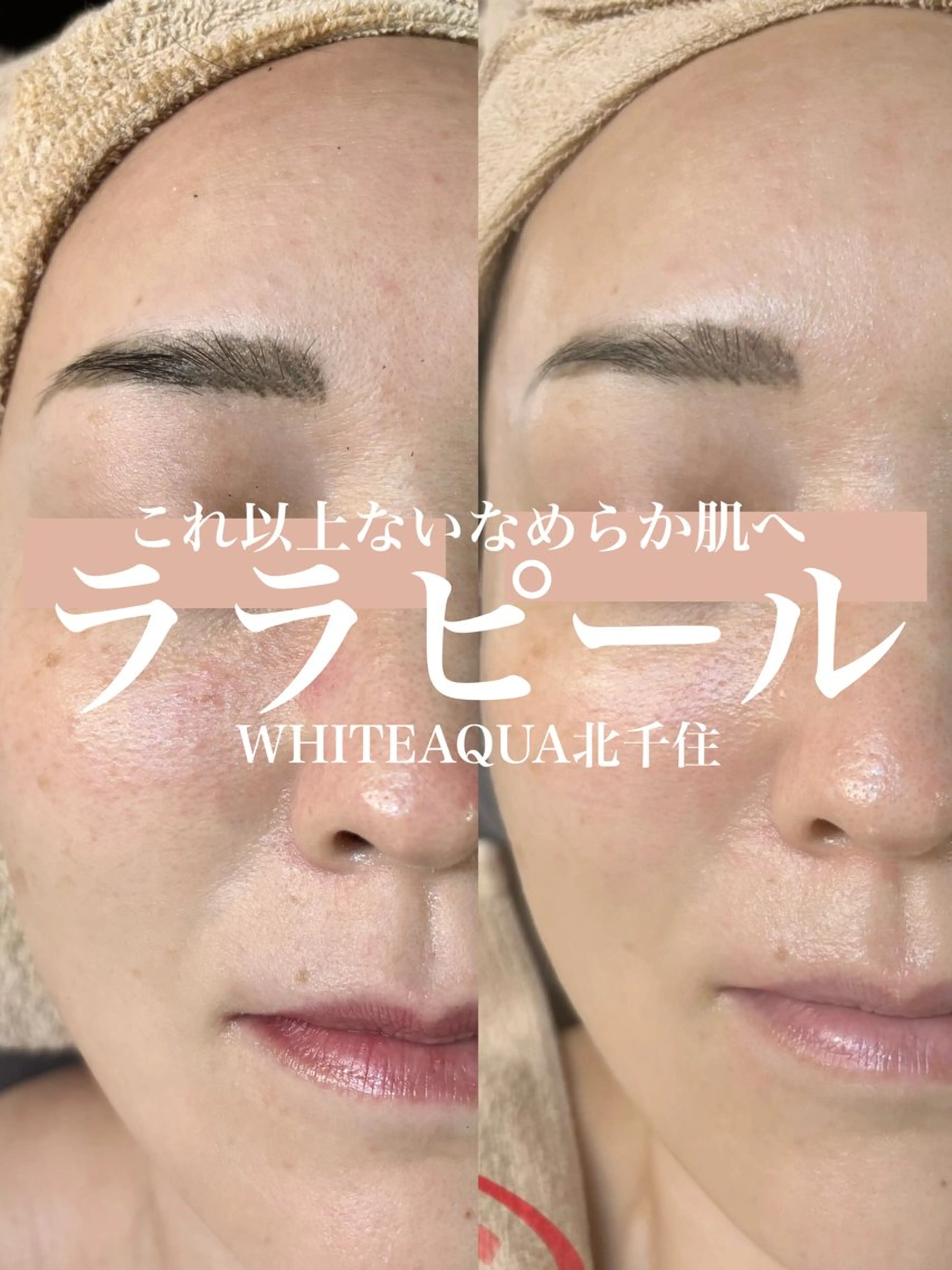 エステ WHITE AQUA 北千住店のエステ・リラクイメージ