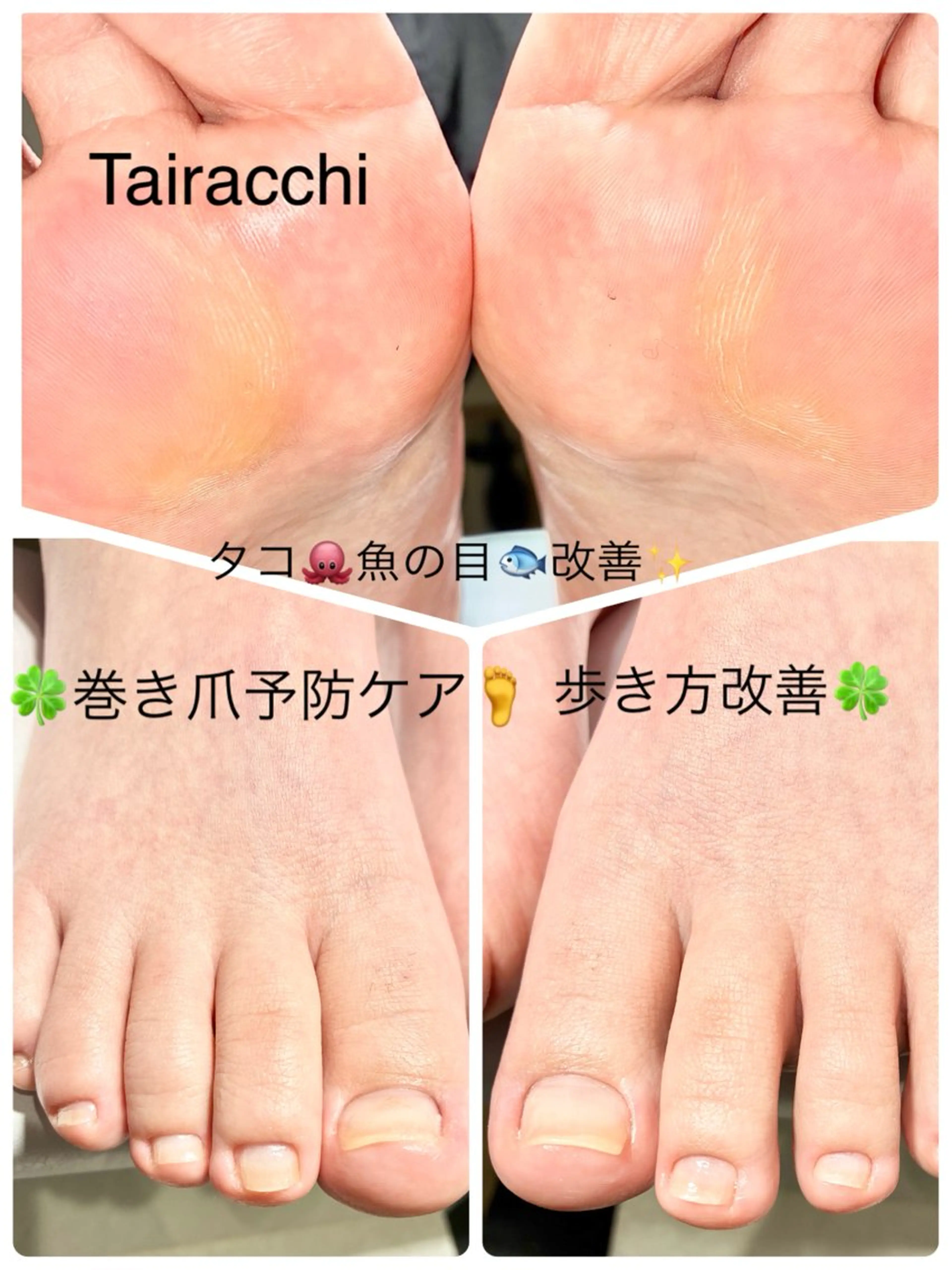 ネイル フットネイル フットネイル Tairacchi ﾀｲﾗｯﾁのネイルデザイン
