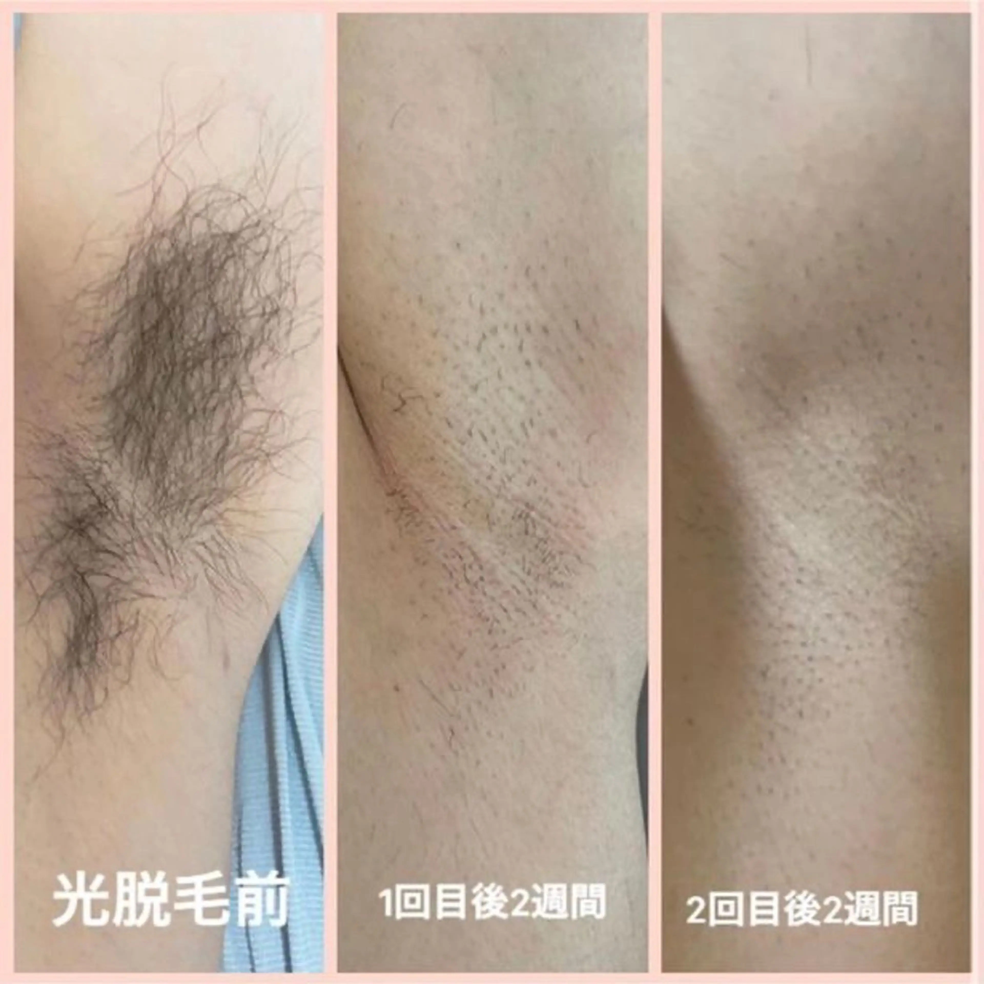 Beauty   Salon  Adiy所属・Adiy ikumiのエステ・リラクイメージ