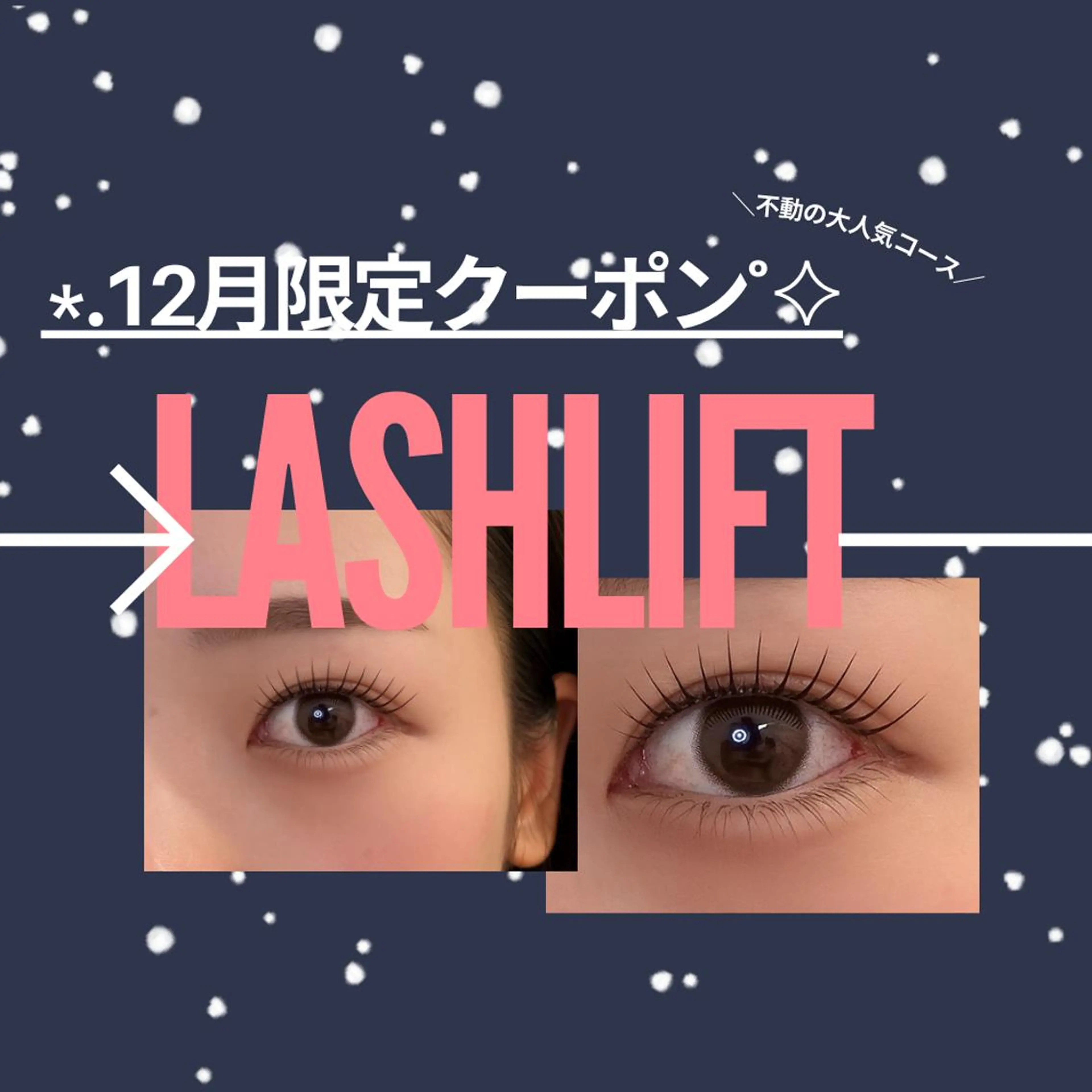 【12月限定】立ち上げ×束感|ラッシュリフト(コーティング付)*7490→6490(予約リクエスト⭕️)の写真