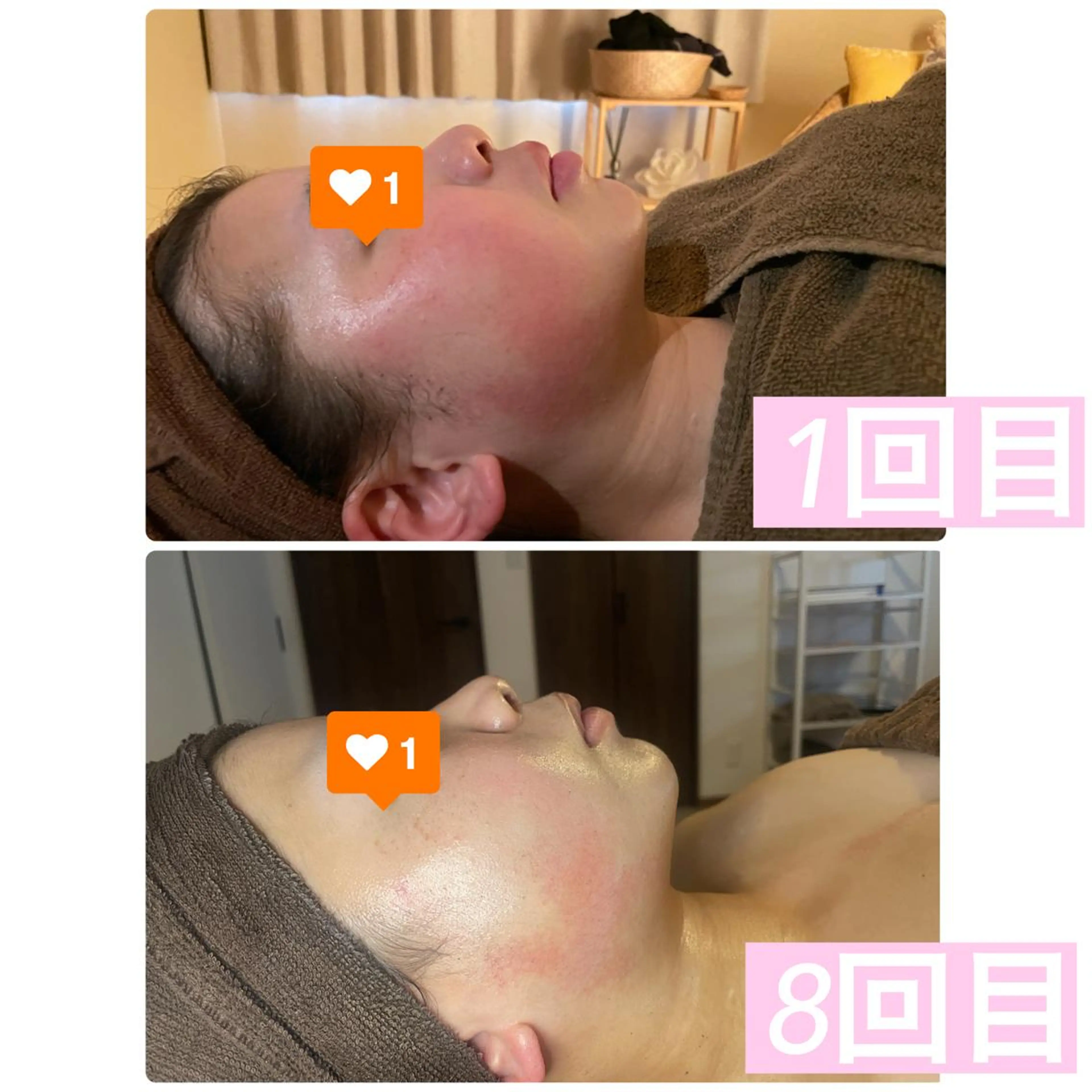 エステ 肌育脱毛サロン LikoLinaのその他イメージ