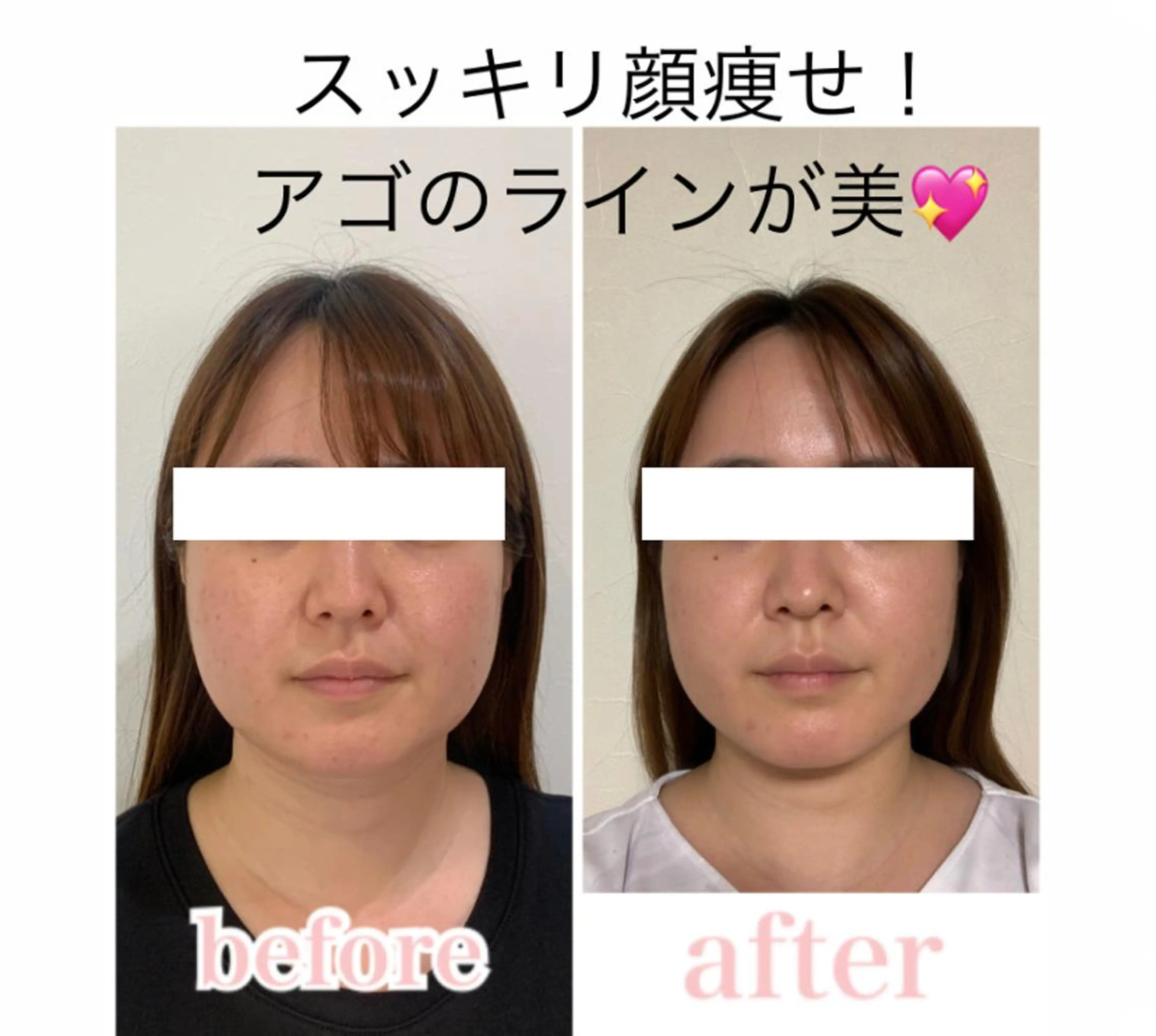 エステ リラク 小顔と ヘッドスパのお店のエステ・リラクイメージ