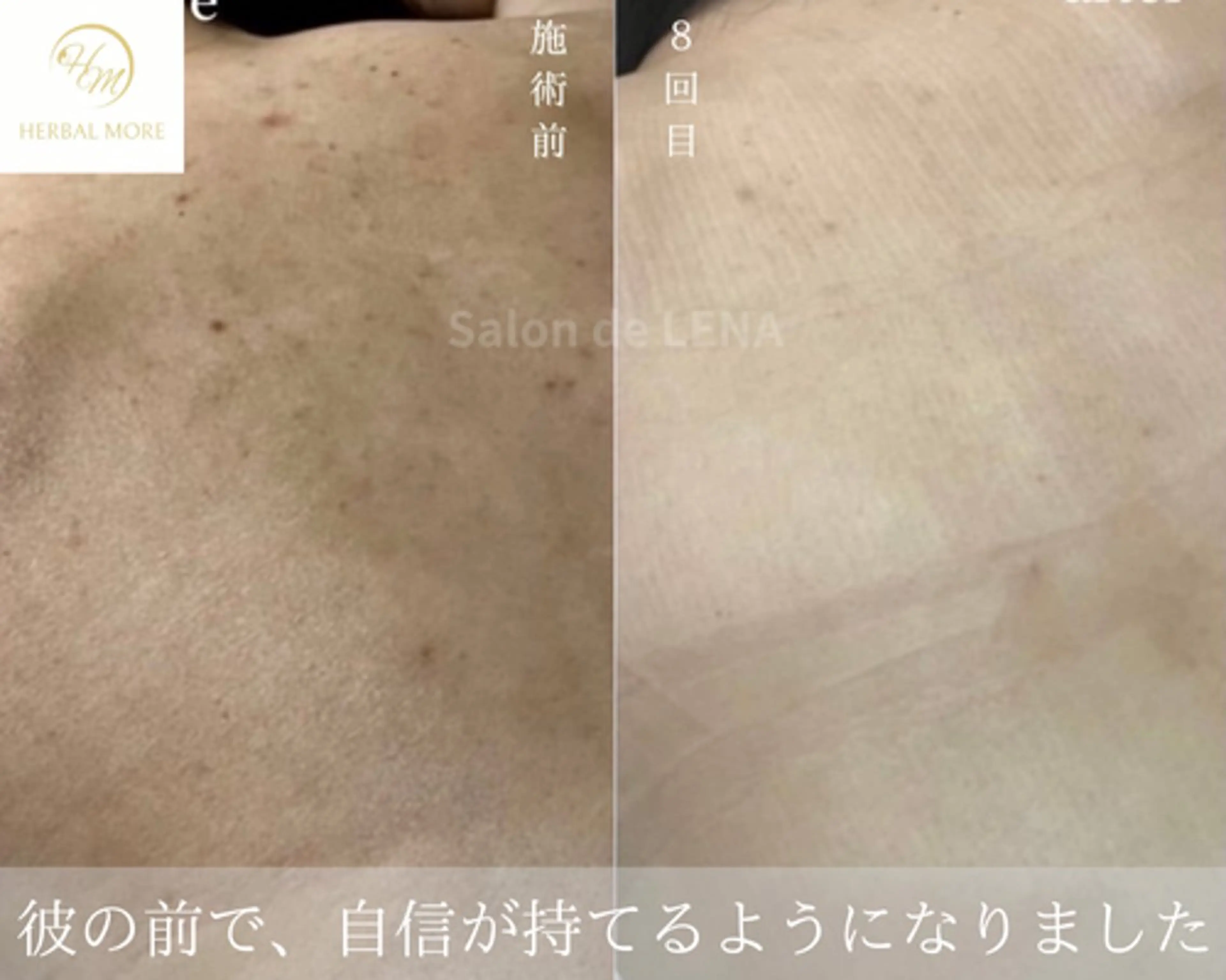 ハーブピーリング・毛穴ケア専門サロンSalon de LENA 栄店所属・ハーブピーリング専門 サロンドレナ　白藤のエステ・リラクイメージ