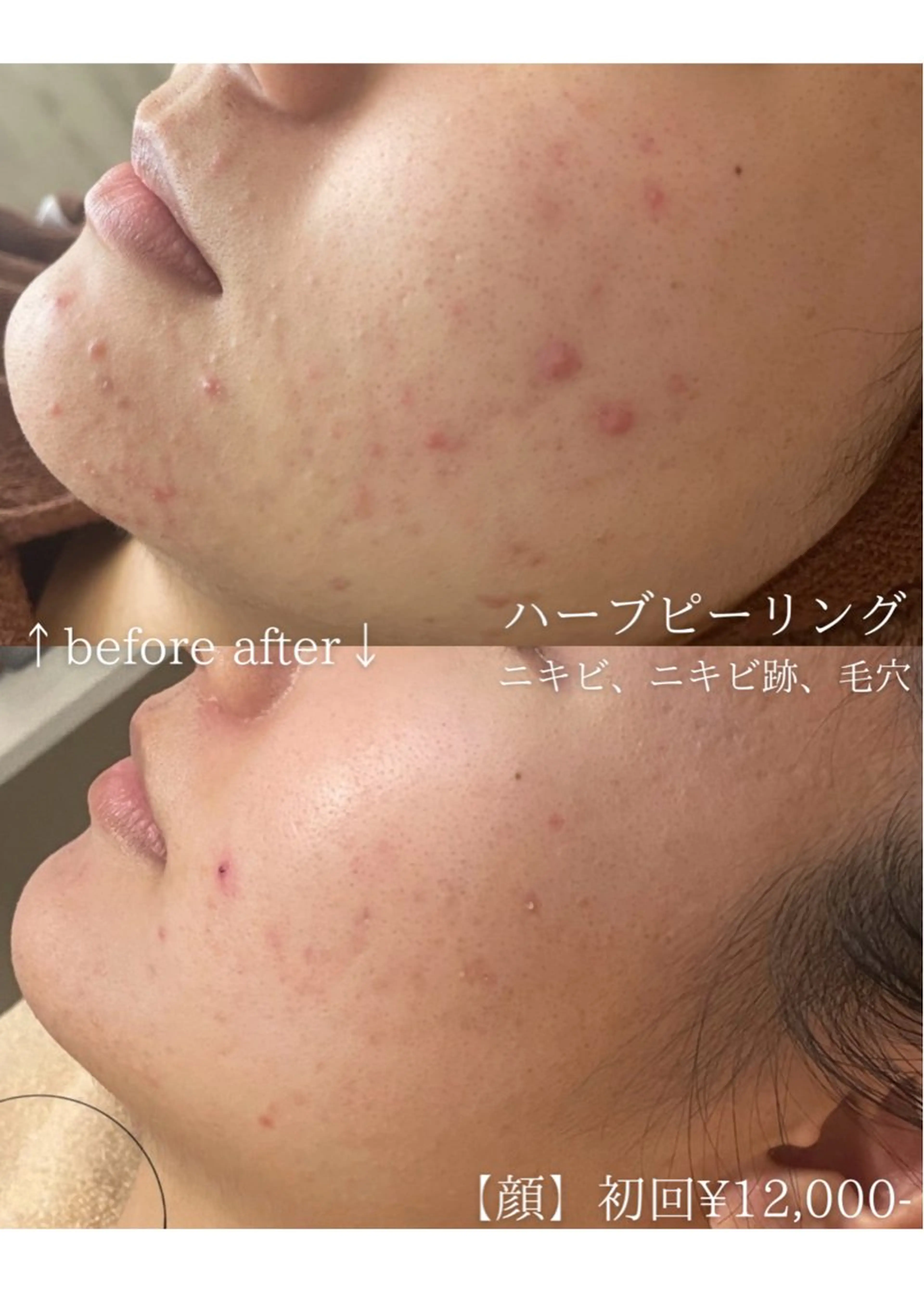 エステ ニキビ改善専門店 d'Albaのエステ・リラクイメージ