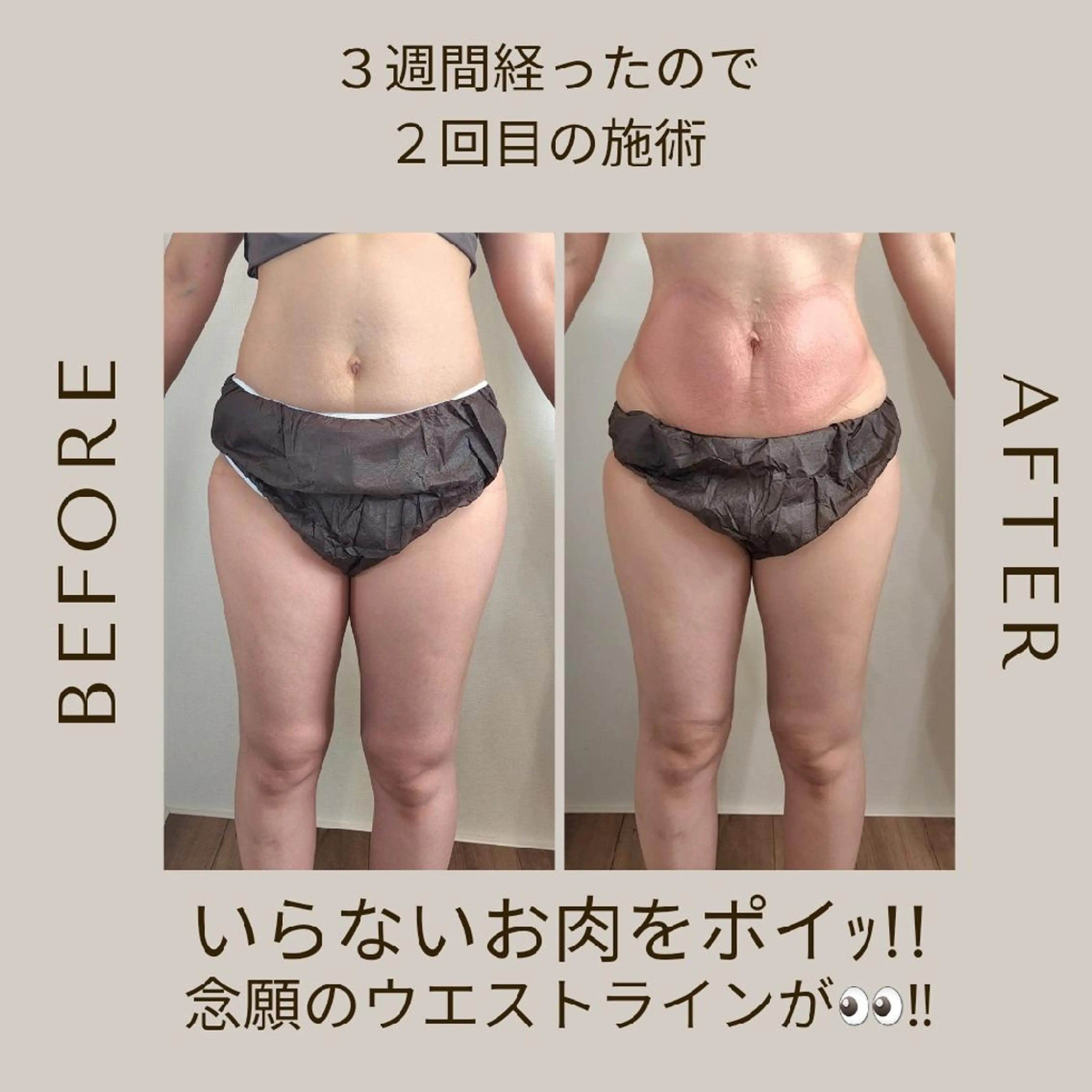 痩身・脂肪冷却サロンcoconoix [ｺｺﾉﾜ]所属・痩身・脂肪冷却サロン coconoix のエステ・リラクイメージ