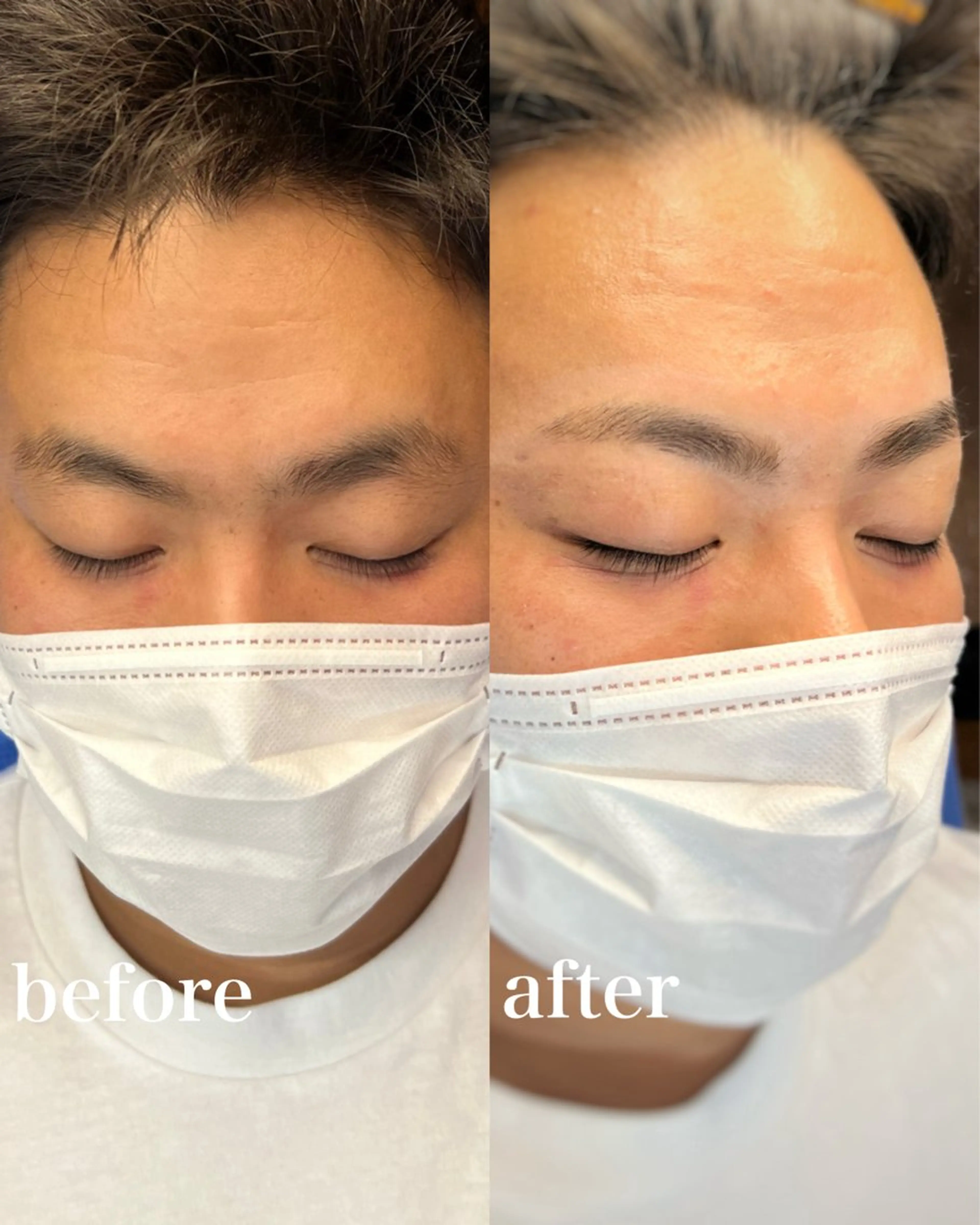 ▪️メンズのお客様限定❕24%OFF▪️眉毛ワックス脱毛＋眉カット🌫の写真