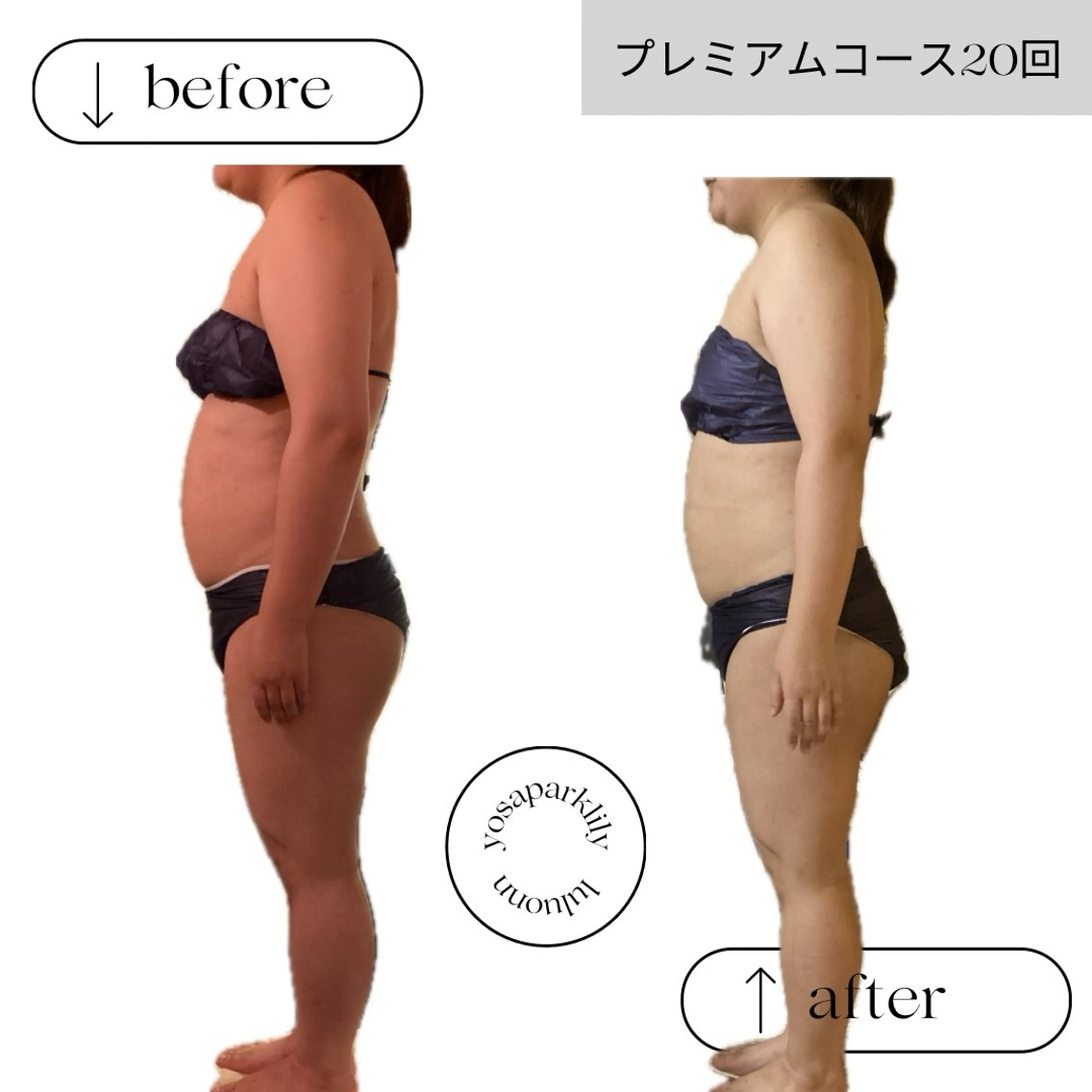 エステ 温活痩身サロン ヨサパークリリーのエステ・リラクイメージ