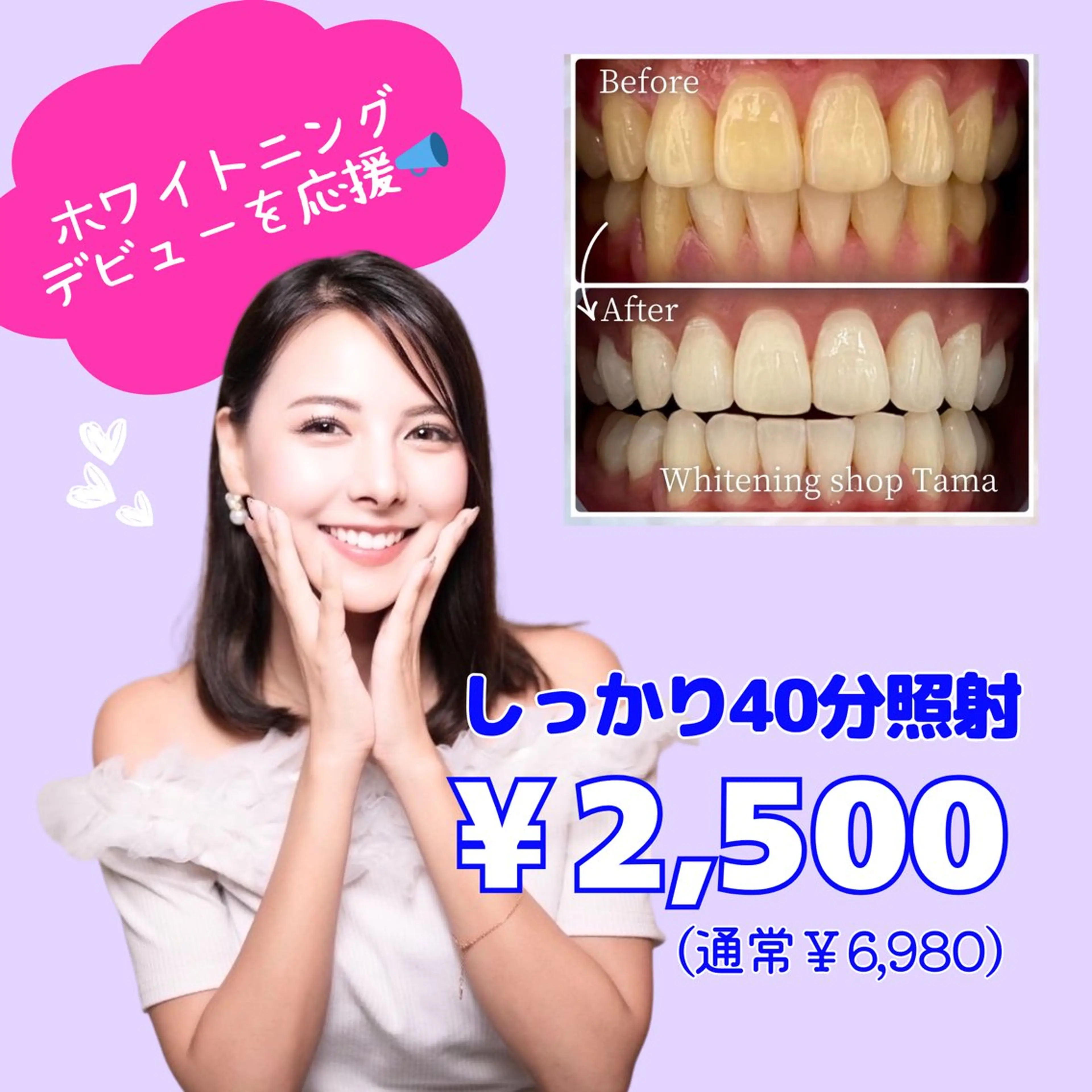 その他 ホワイトニング ショップ多摩店のその他イメージ