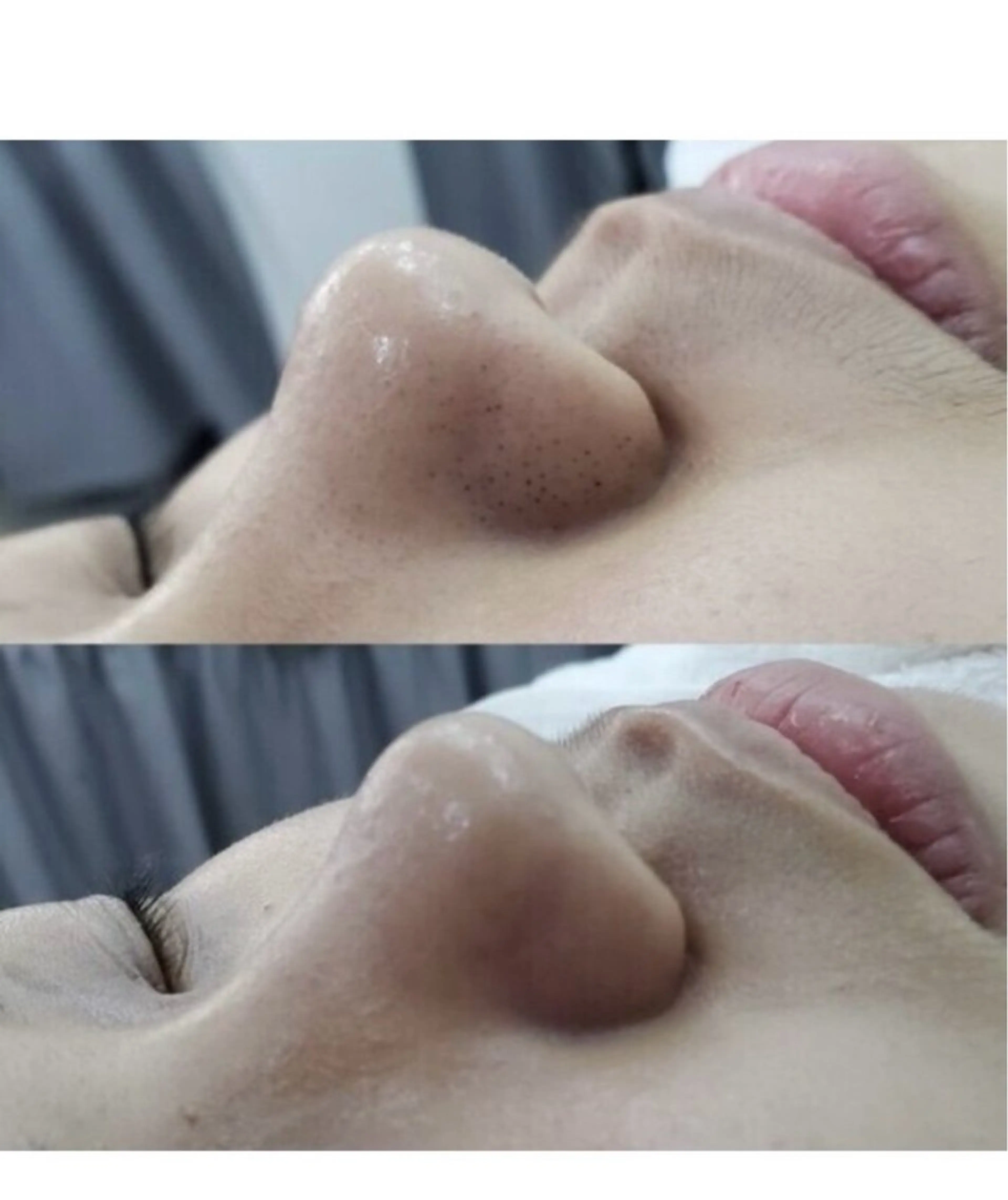 エステ エムズ ビューティスタジオのエステ・リラクイメージ