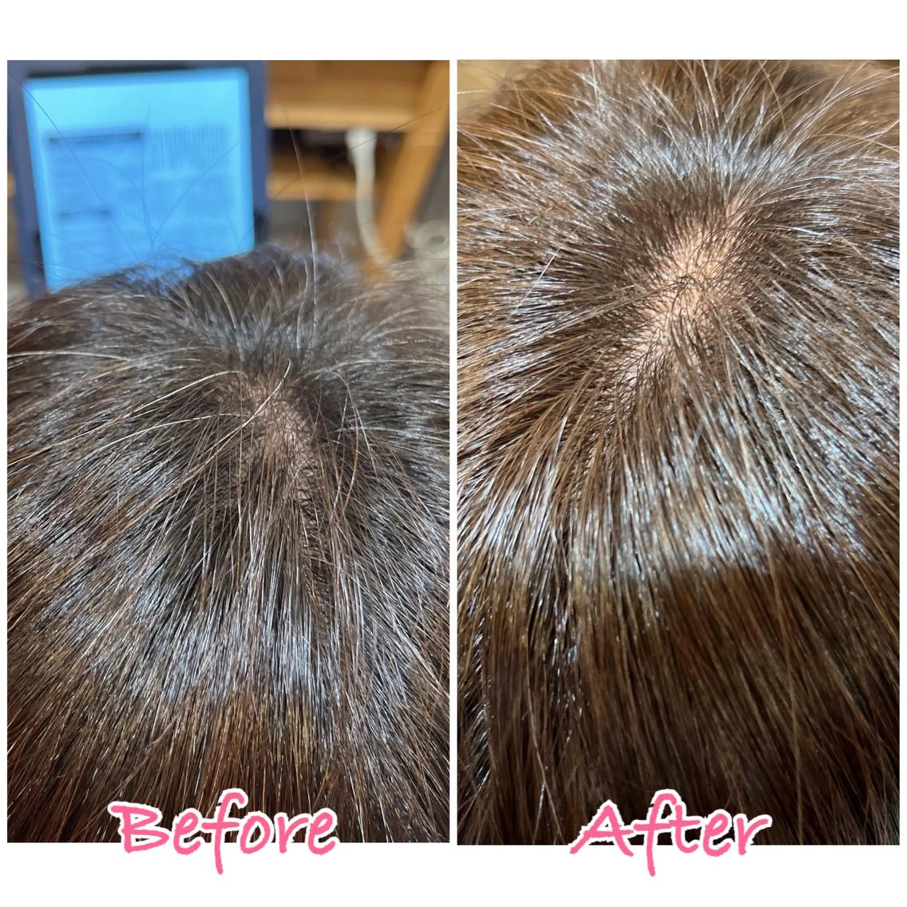 カラー ショートカット 🌸 飯野 舞桜のヘアスタイル