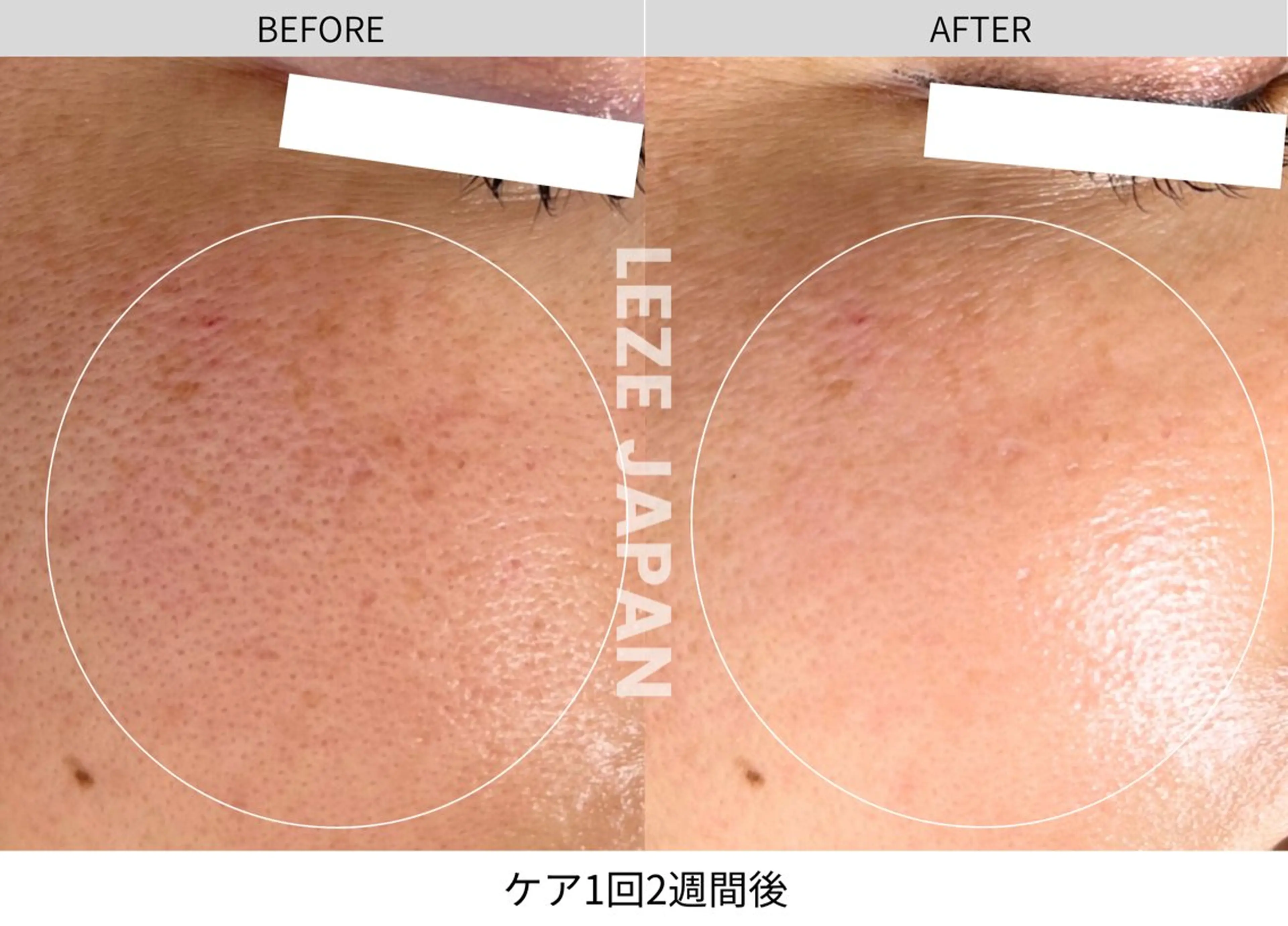 LA CLARTE所属・LA CLARTEのエステ・リラクイメージ