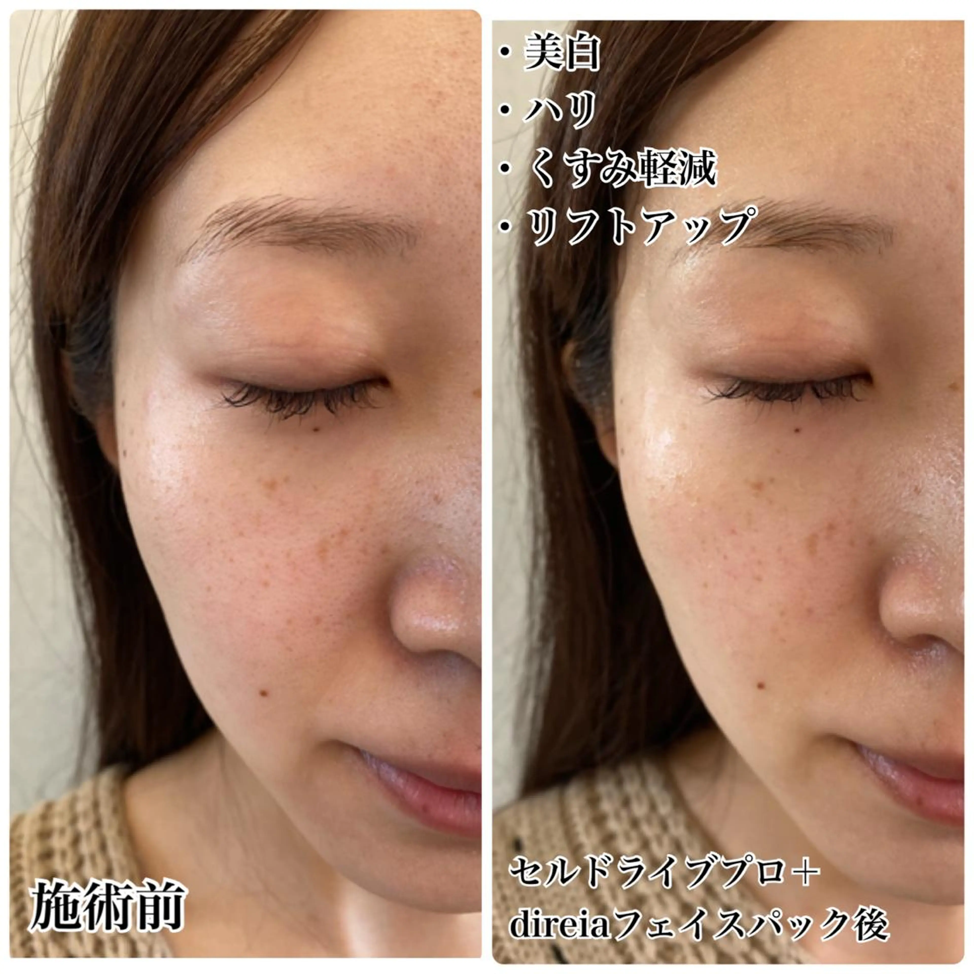 Venus所属・エステサロン Venusのエステ・リラクイメージ