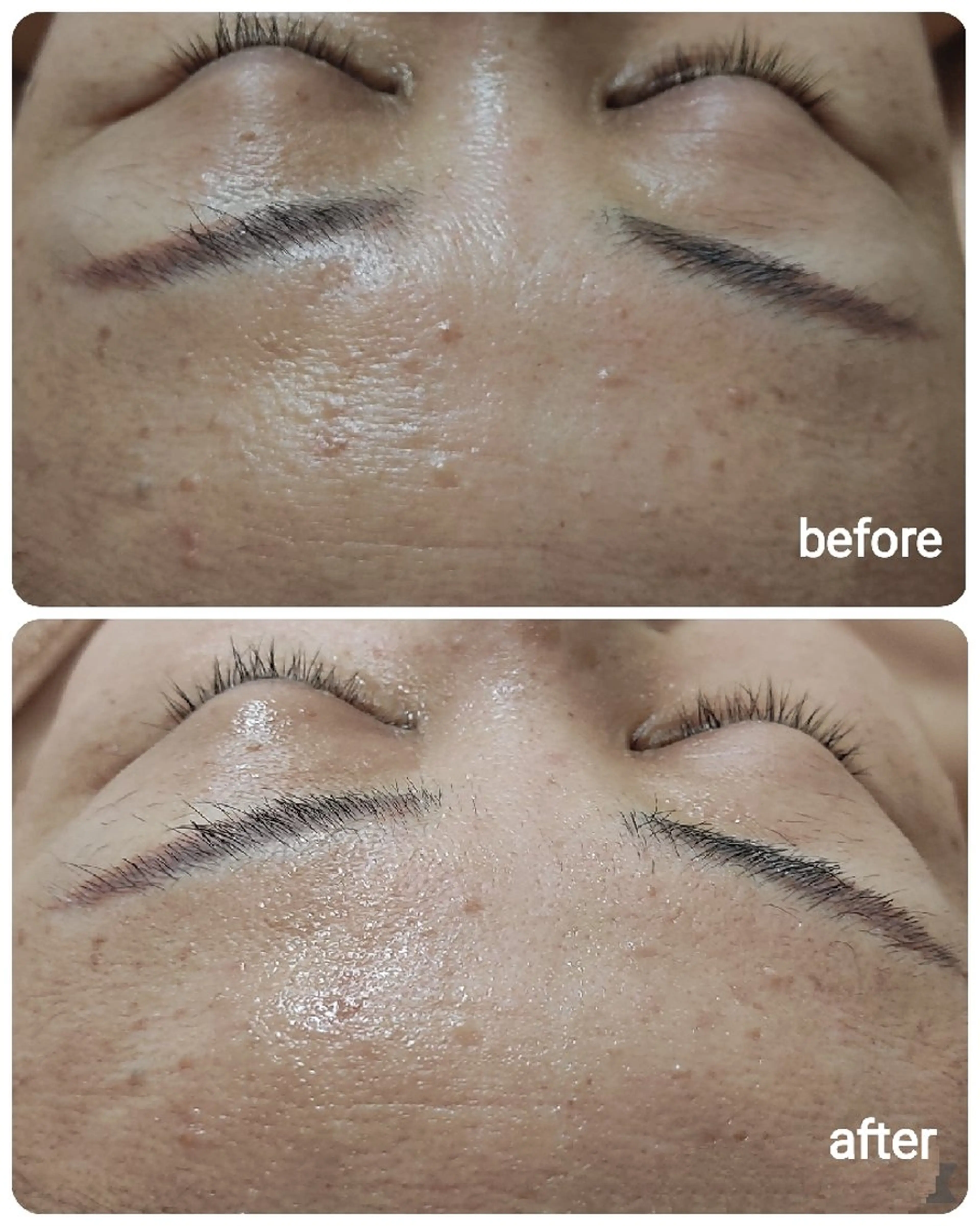 山野愛子どろんこ美容〜Lough〜所属・山野愛子どろんこ美容 Loughのエステ・リラクイメージ