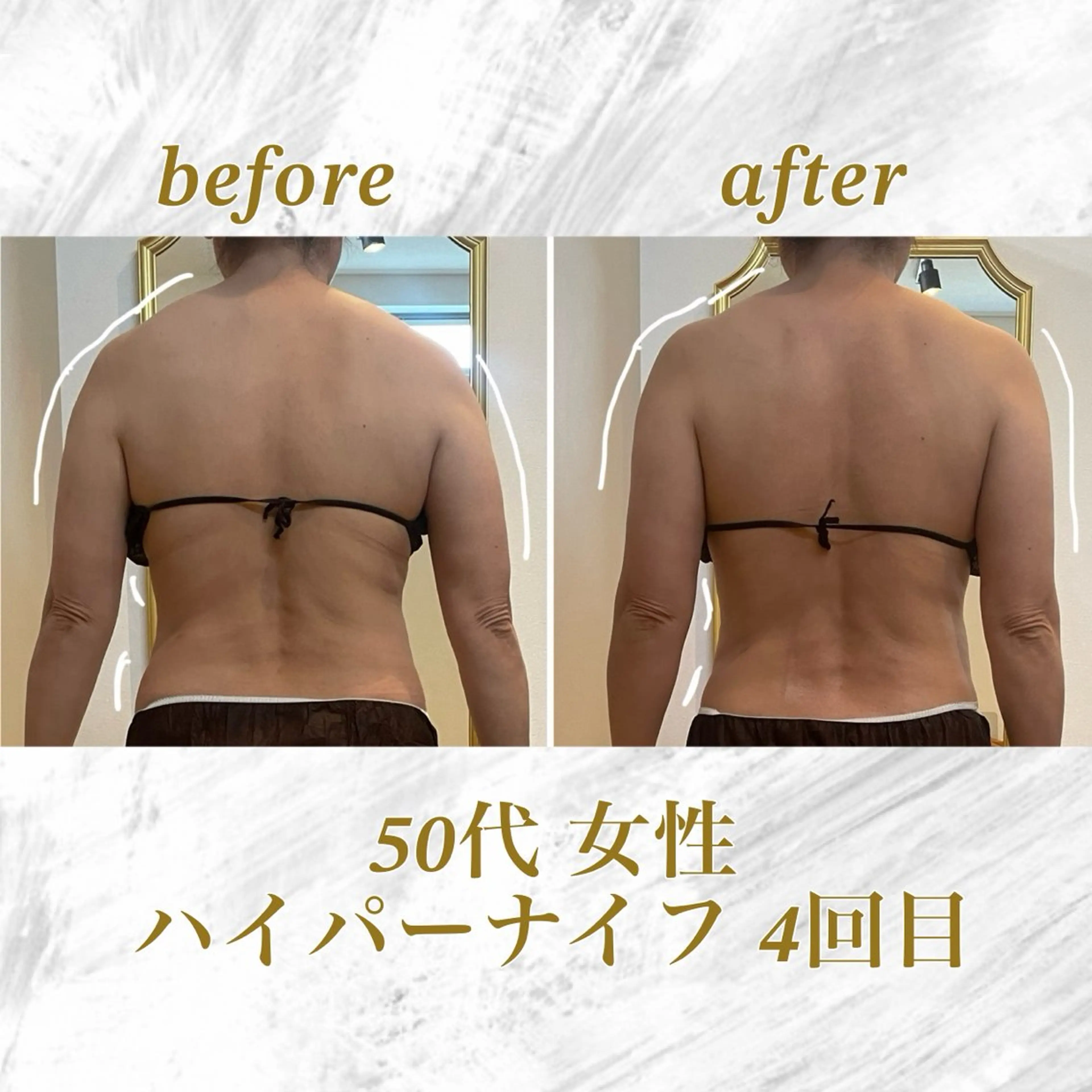 ハイパーナイフ 上半身or下半身の写真