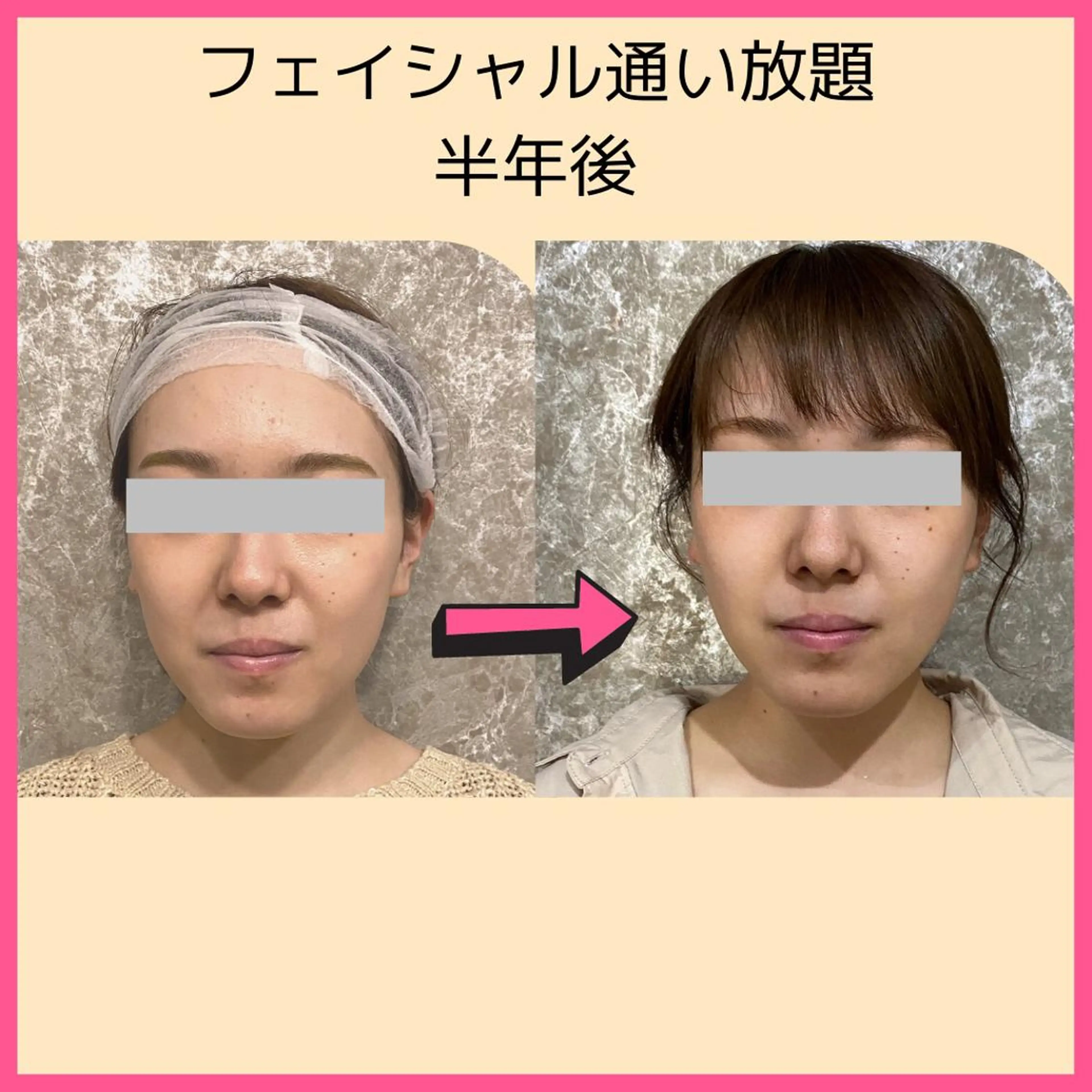 20代から始める脱毛 salonLEPIAのエステ・リラクイメージ