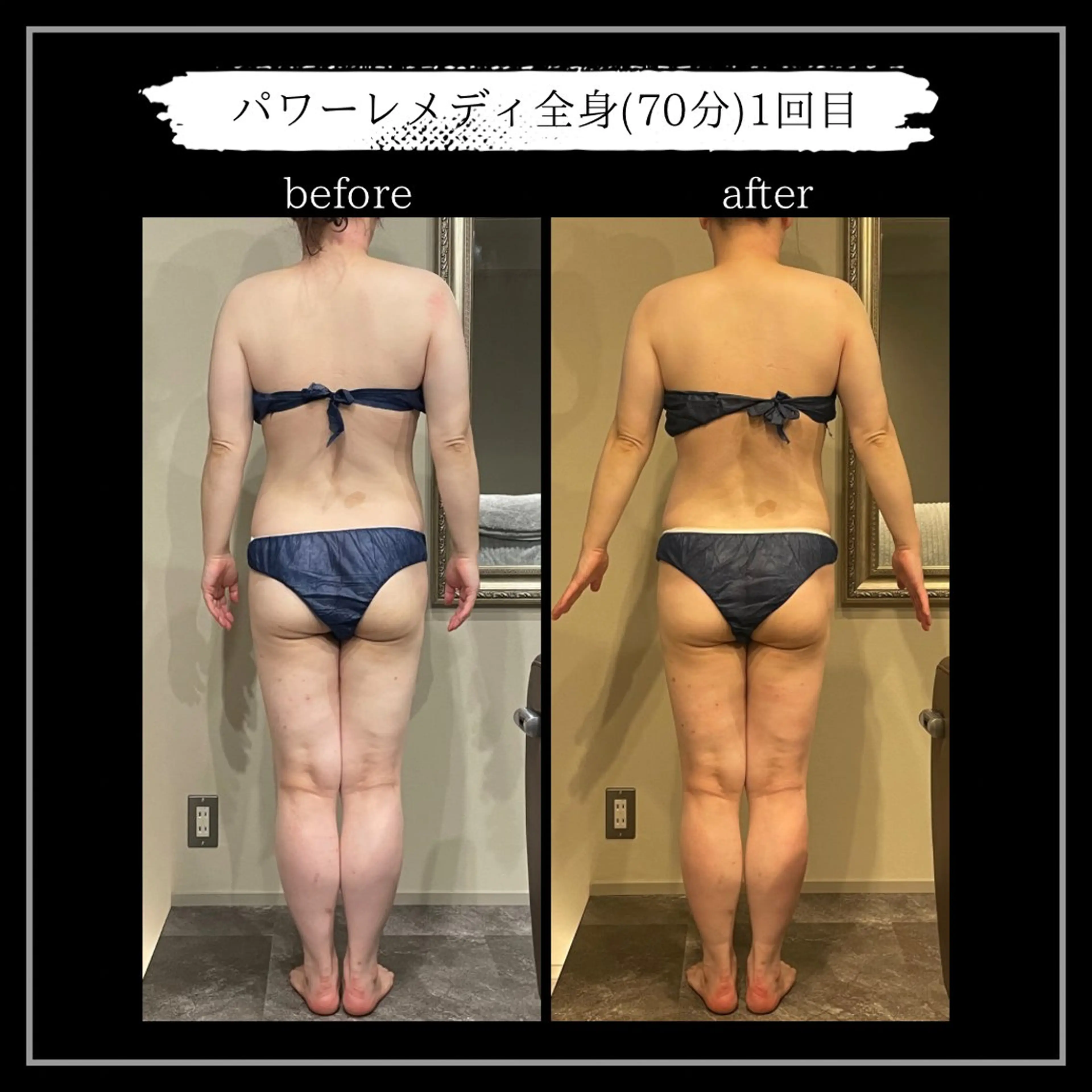 エステ リラク オフ:オン所属・オフ:オン 全身筋膜マッサージのエステ・リラクイメージ