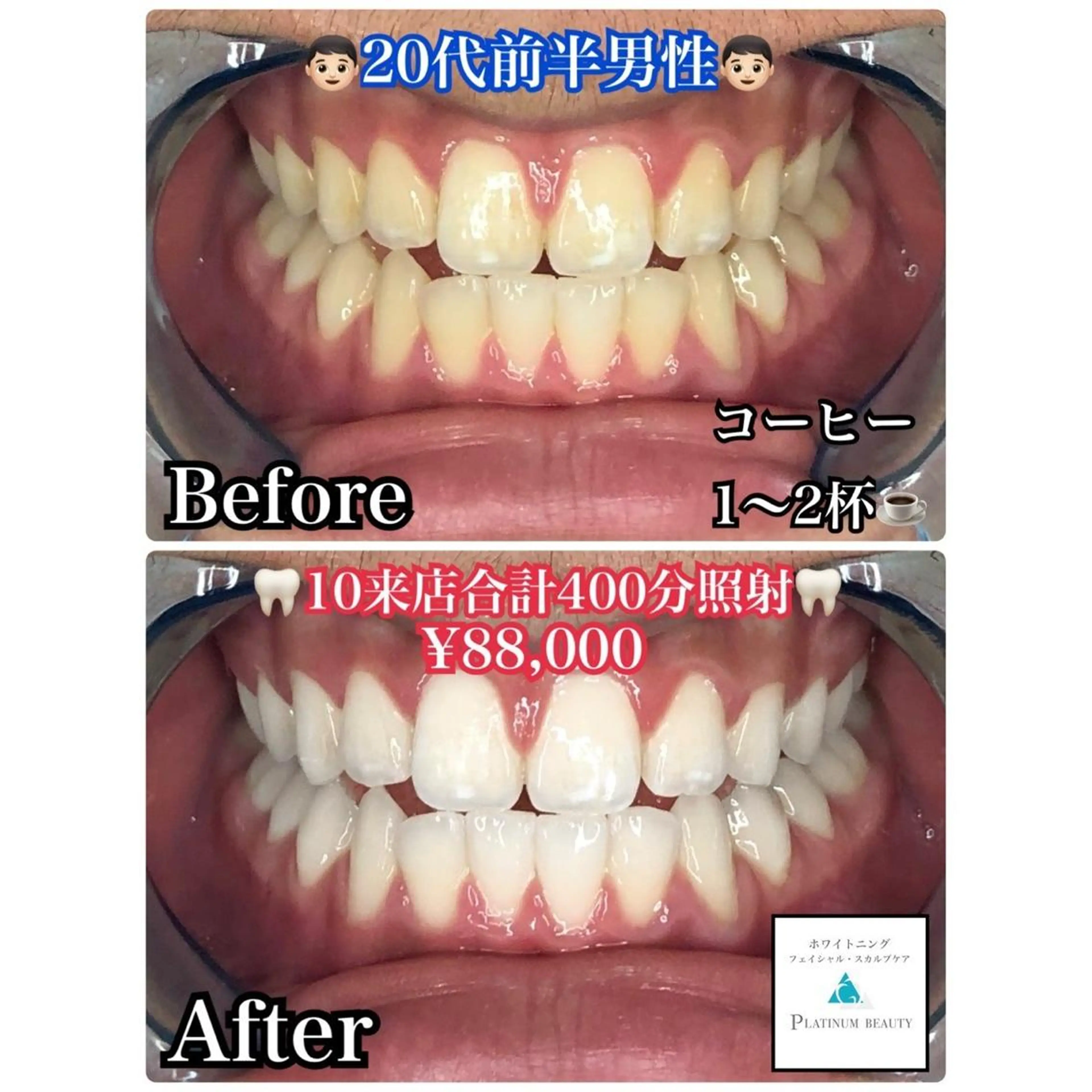 ホワイトニングビューティー西宮店所属・ホワイトニングビュー ティー西宮店のその他イメージ