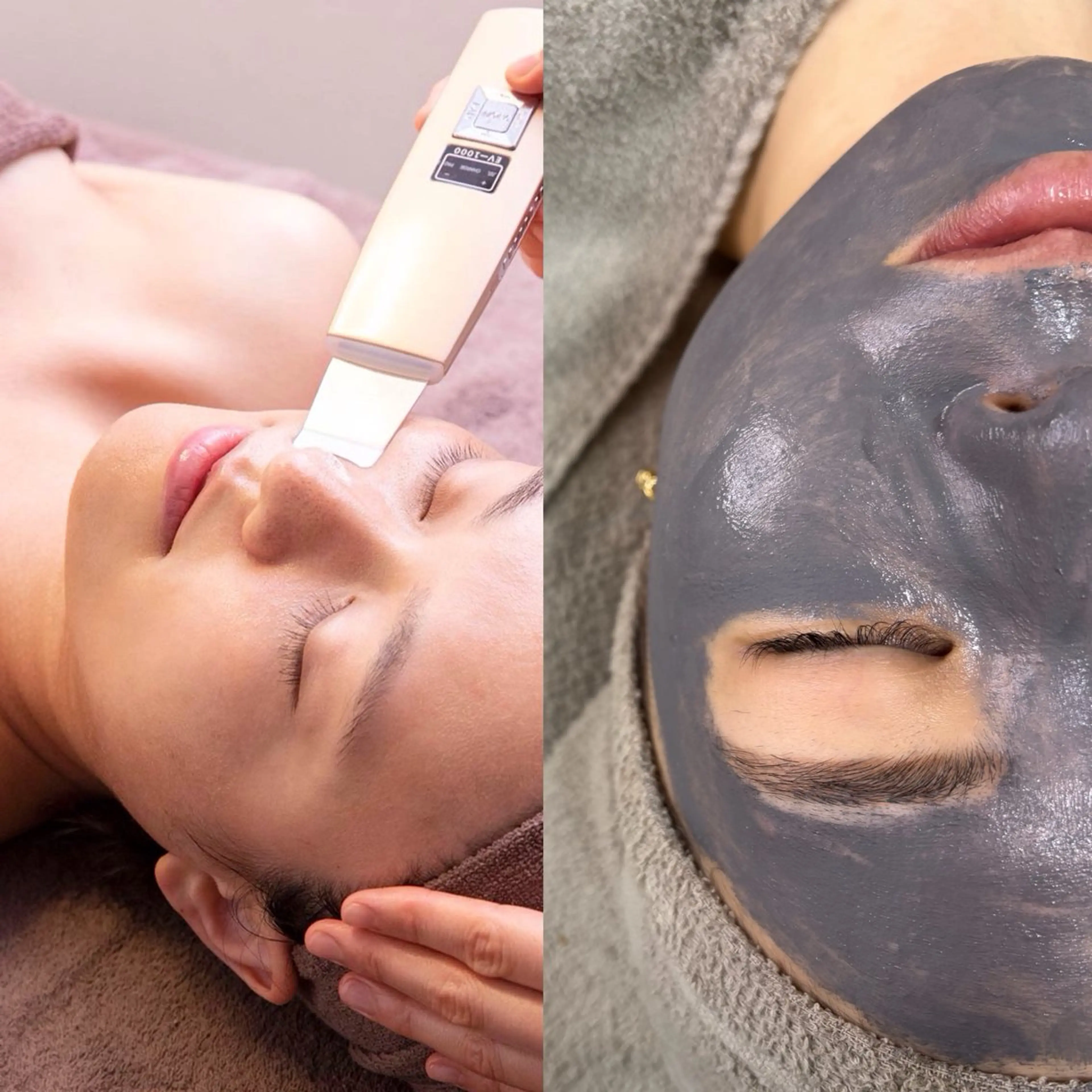 【毛穴集中ケア】洗浄＋磁気パックで透明感爆誕☆美肌ケアの写真