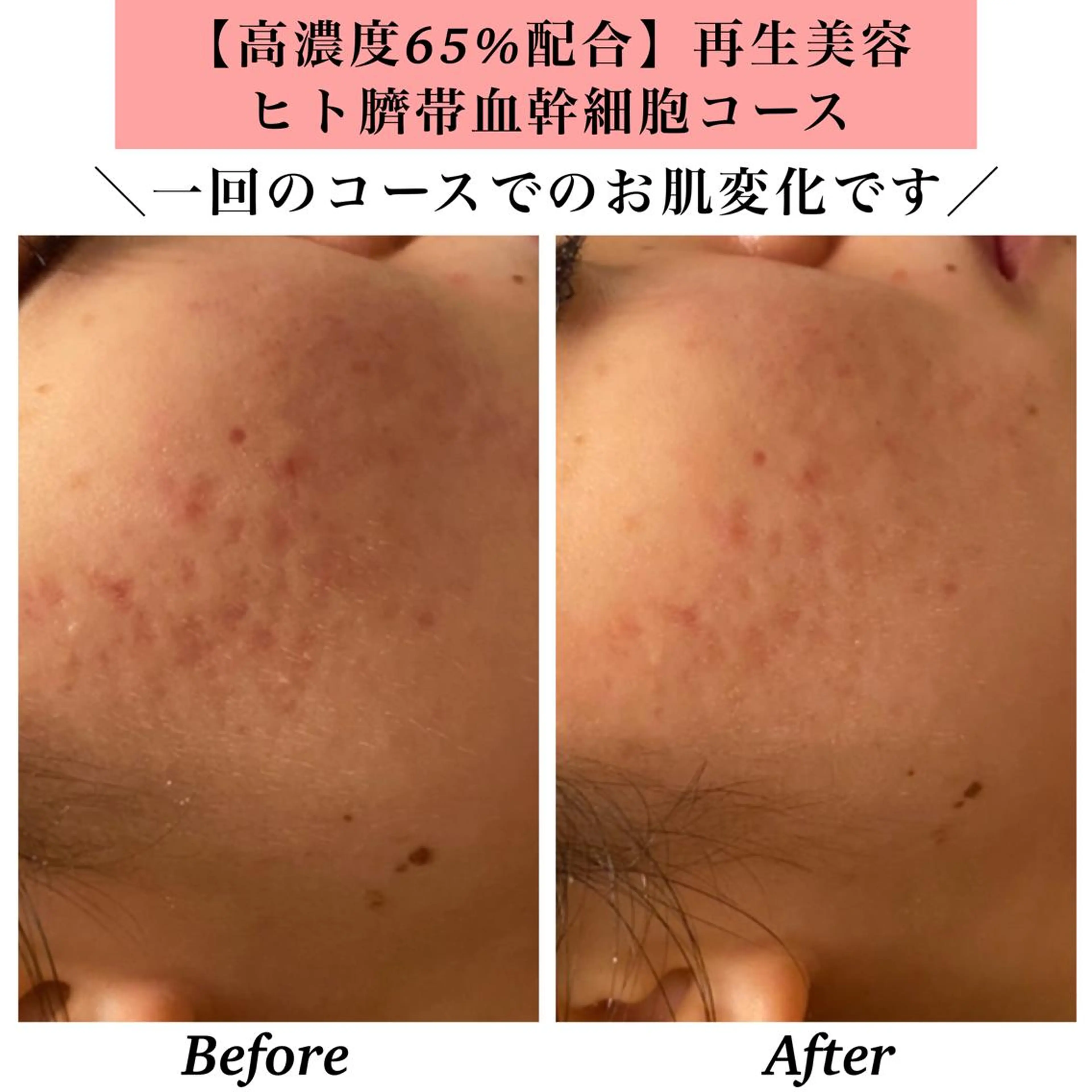 エステ リラク Bellesthe (ベルエステ)のエステ・リラクイメージ