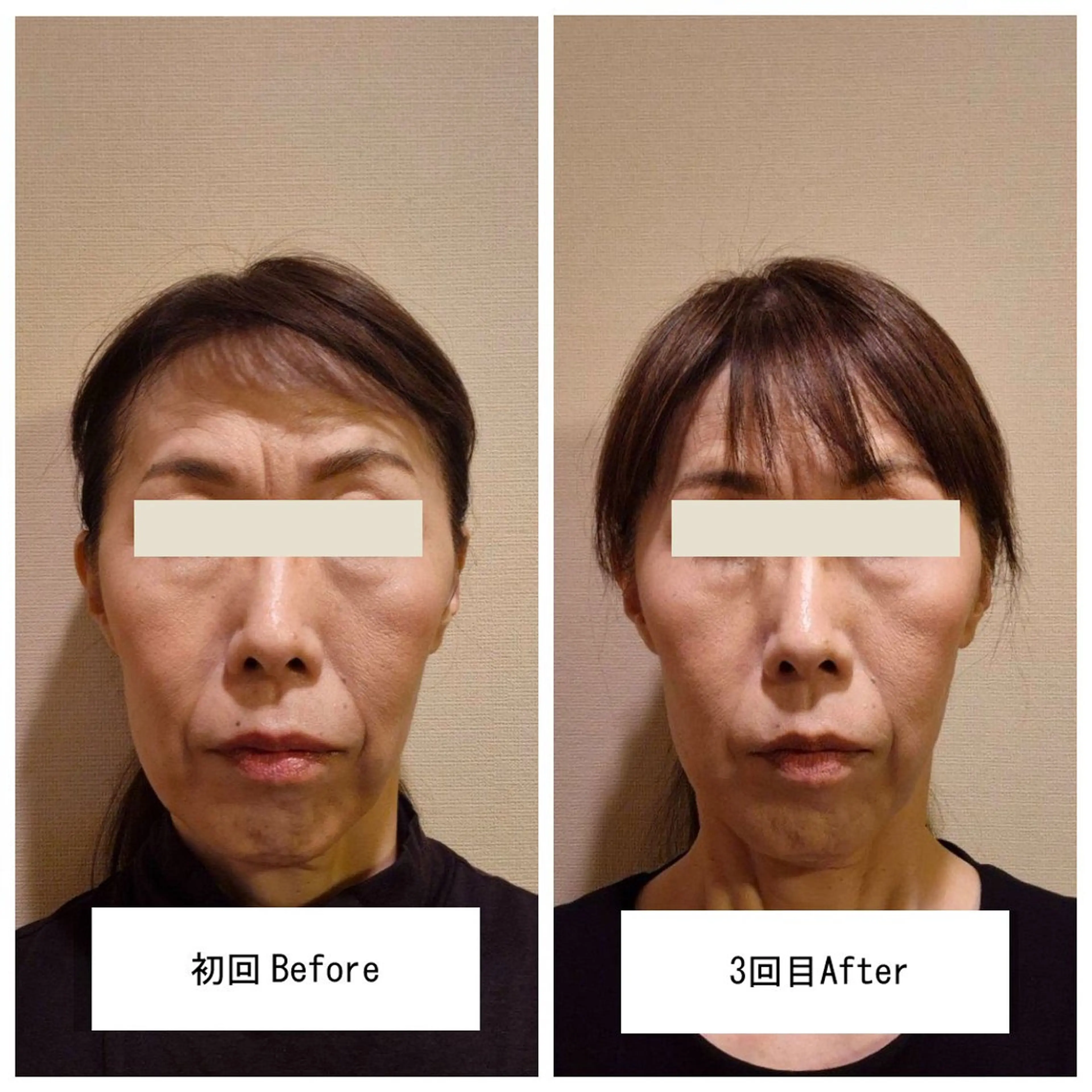 晴れ晴れ 整体院のエステ・リラクイメージ