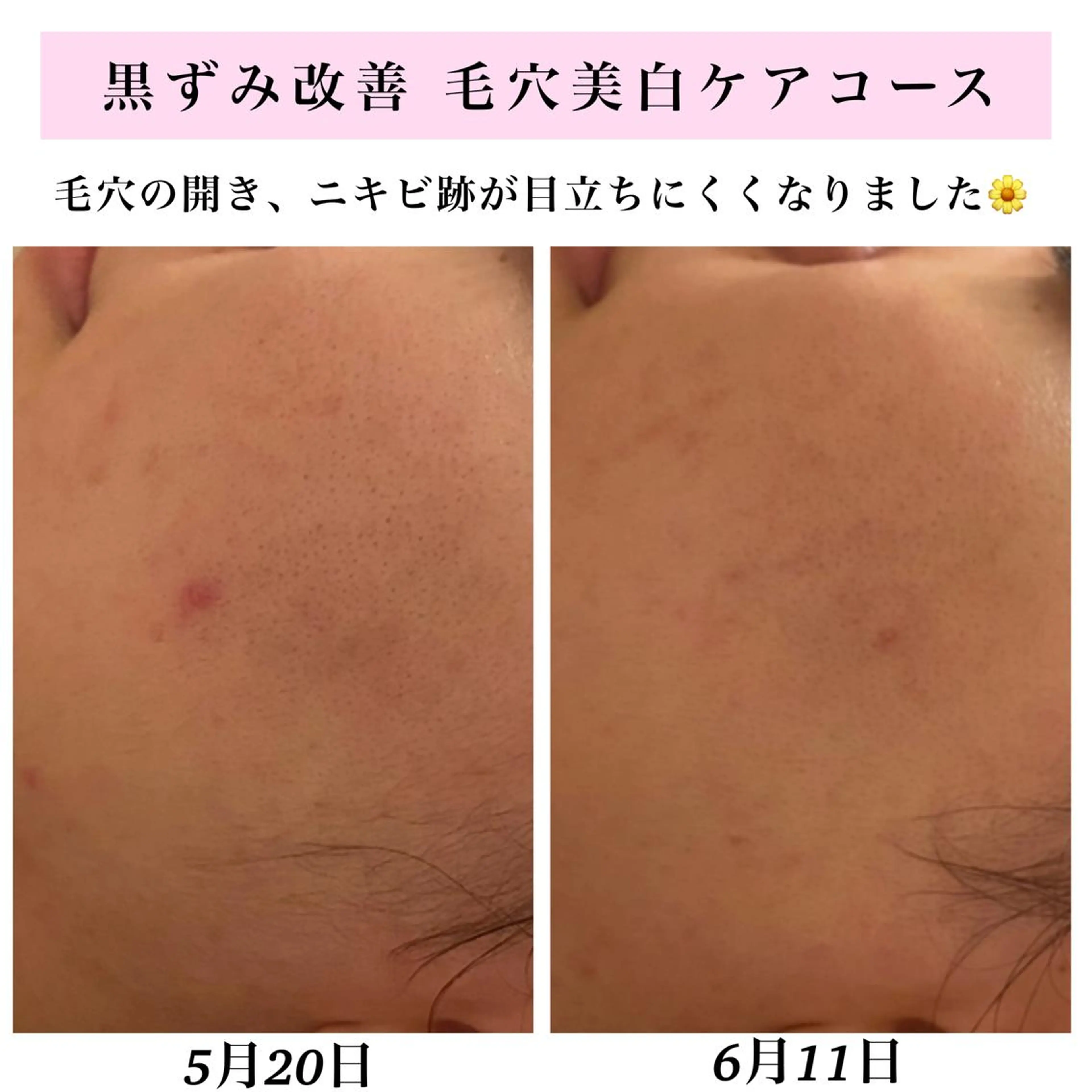 エステ リラク Bellesthe （ベルエステ）のエステ・リラクイメージ